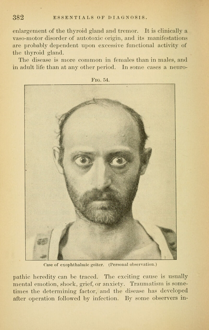 enlargement of the thyroid gland and tremor. It is clinically a vaso-motor disorder of autotoxic origin, and its manifestations are probably dependent upon excessive functional activity of the thyroid gland. The disease is more common in females than in males, and in adult life than at any other period. In some cases a neuro- FiG. 54. Case of exophthalmic goiter. (Personal observation.) pathic heredity can be traced. The exciting cause is usually mental emotion, shock, grief, or anxiety. Traumatism is some- times the determining factor, and the disease has developed after operation followed by infection. By some observers in-