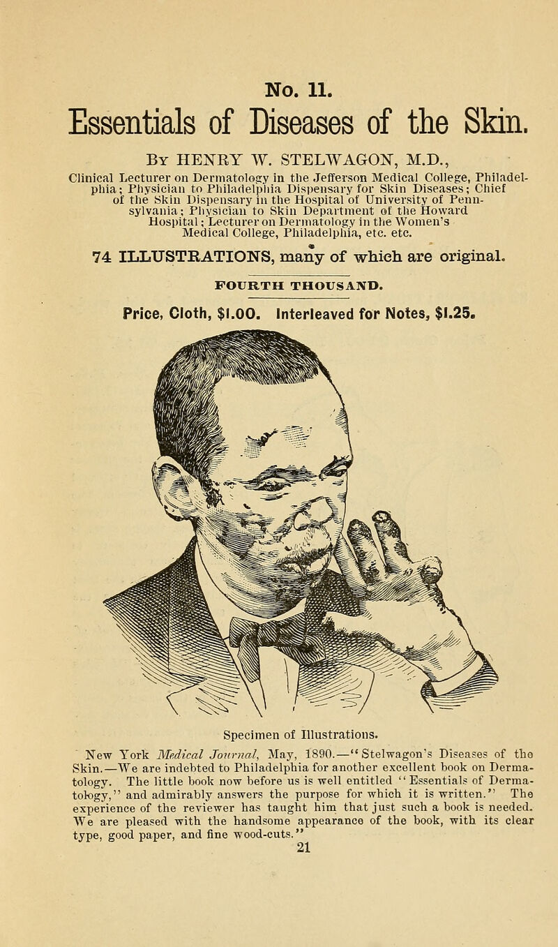 Essentials of Diseases of the Skin. By henry W. STELWAGON, M.D., Clinical Lecturer on Derinatolojry in the Jefferson Medical College, Philadel- phia; Physician to Philadelphia Dispensary for Skin Diseases; Chief of the Sl?in Disi)ensa7-y in the Hospital of University of Penn- sylvania; Physician to Skin Department of the Howard Hospital; Lecturer on Dermatology in tlie Women's Medical College, Philadelphia, etc. etc. 74 ILLUSTRATIONS, many of which are original. FOURTH THOUSAND. Price, Cloth, $I.OO. Interleaved for Notes, $1.25. Specimen of Illustrations. New York Medical Journal, May, 1890.—Stelwagon's Diseases of tho Skin.—We are indebted to Philadelphia for another excellent book on Derma- tology. The little book now before us is well entitled Essentials of Derma- tol-ogy, and admirably answers the purpose for which it is written. Tho experience of the reviewer has taught him that just such a book is needed. We are pleased with the handsome appearance of the book, with its clear type, good paper, and fine wood-cuts.