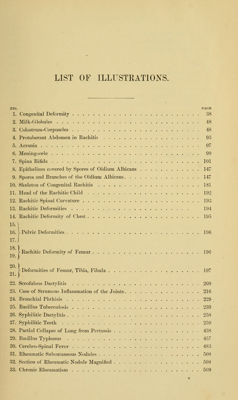 LIST OF ILLUSTRATIONS. FIG. PAGE 1. Congenital Deformity 38 2. Milk-Globules 48 3. Colostrum-Corpuscles 48 4. Protuberant Abdomen in Rachitis 93 5. Acrania 97 6. Meningocele 99 7. Spina Bitida 101 8. Epitlieliuni covered by Spores of Oi'dium Albicans 147 9. Spores and Branches of the Oi'dium Albicans 147 10. Skeleton of Congenital Rachitis 181 11. Head of the Rachitic Child 192 12. Rachitic Spinal Curvature 193 13. Rachitic Deformities 194 14. Rachitic Deforniity of Chest 195 10. ■, 16. j-Pelvic Deformities 196 17.J V Rachitic Deformity of Femur 196 19. J 20.1 Deformities of Femur, Tibia, Fibula 197 22. Scrofulous Dactylitis 209 23. Case of Strumous Inflammation of the Joints 216 24. Bronchial Phthisis 229 25. Bacillus Tuberculosis 239 26. Syphilitic Dactylitis 258 27. Syphilitic Teeth  259 28. Partial Collapse of Lung from Pertussis 438 29. Bacillus Typhosus 457 30. Cerebro-Spinal Fever 483 31. Rheumatic Subcutaneous Nodules 508 32. Section of Rheumatic Nodule Magnified 508 33. Chronic Rheumatism 509