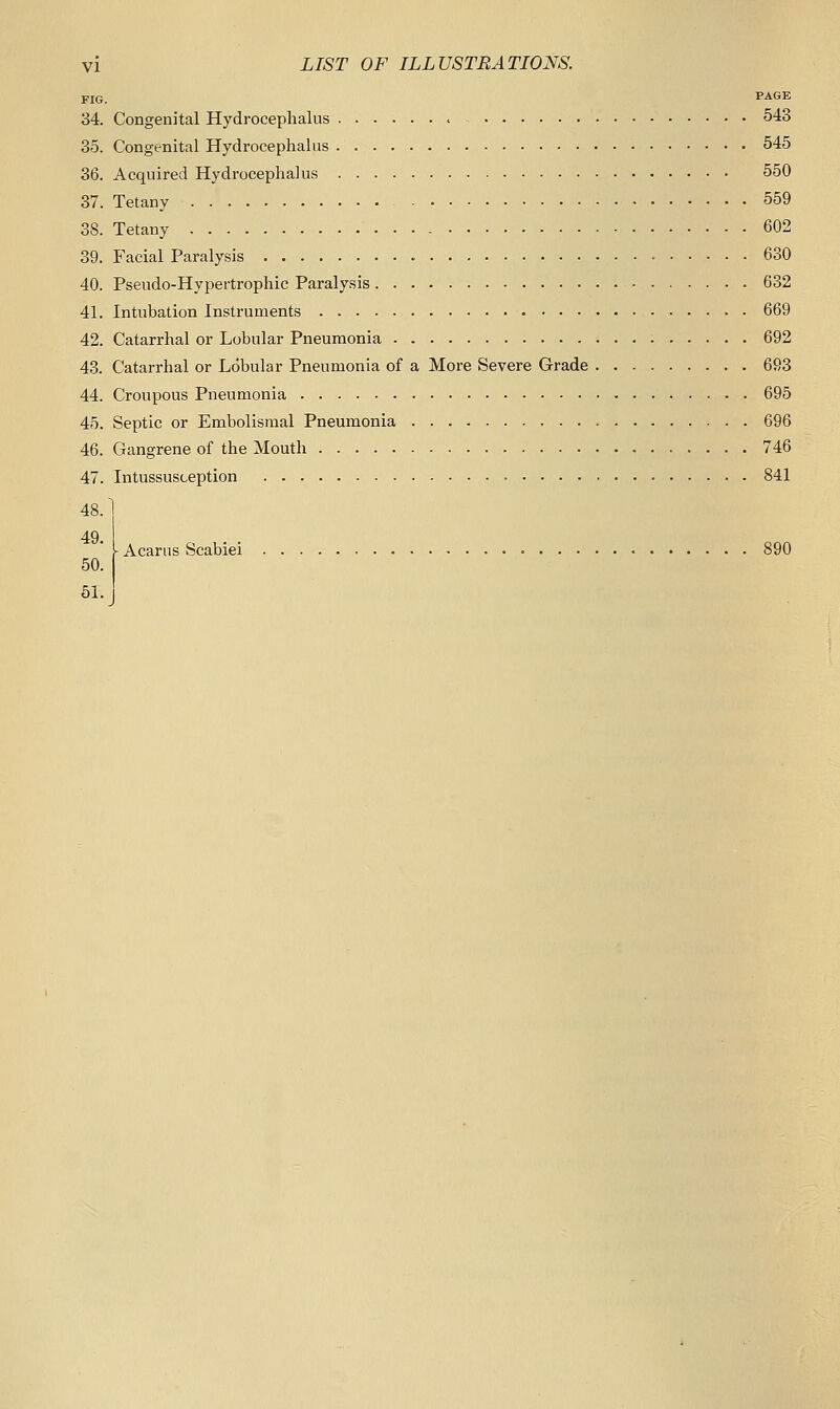 FIG. P^GE 34. Congenital Hydrocephalus > 543 35. Congenital Hydrocephalus 545 36. Acquired Hydrocephalus 550 37. Tetany 559 38. Tetany 602 39. Facial Paralysis • 630 40. Pseudo-Hypertrophic Paralysis 632 41. Intubation Instruments 669 42. Catarrhal or Lobular Pneumonia 692 43. Catarrhal or Lobular Pneumonia of a More Severe Grade 693 44. Croupous Pneumonia 695 45. Septic or Embolisraal Pneumonia 696 46. Gangrene of the Mouth 746 47. Intussusception 841 48. 49. 50. 51. Acarus Scabiei 890