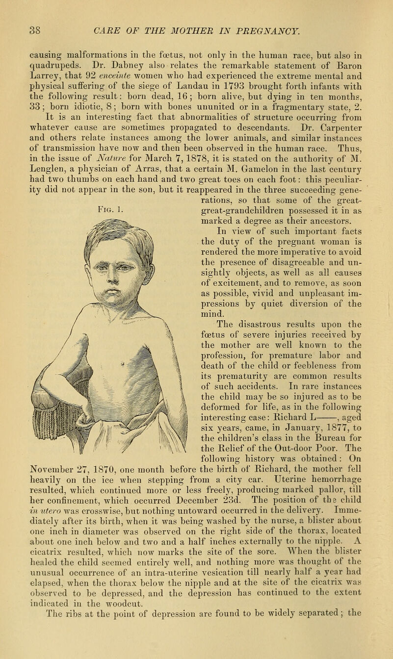 Fig. 1. causing malformations in the foetus, not only in the human race, but also in quadrupeds. Dr. Dabney also relates the remarkable statement of Baron Larrey, that 92 enceinte women who had experienced the extreme mental and physical suffering of the siege of Landau in 1793 brought forth infants with the following result: born dead, 16; born alive, but dying in ten months, 33; born idiotic, 8; born with bones ununited or in a fragmentary state, 2. It is an interesting fact that abnormalities of structure occurring from whatever cause are sometimes propagated to descendants. Dr. Carpenter and others relate instances among the lower animals, and similar instances of transmission have now and then been observed in the human race. Thus, in the issue of Nature for March 7,1878, it is stated on the authority of M. Lenglen, a physician of Arras, that a certain M. Gamelon in the last century had two thumbs on each hand and two great toes on each foot: this peculiar- ity did not appear in the son, but it reappeared in the three succeeding gene- rations, so that some of the great- great-grandchildren possessed it in as marked a degree as their ancestors. In view of such important facts the duty of the pregnant woman is rendered the more imperative to avoid the presence of disagreeable and un- sightly objects, as well as all causes of excitement, and to remove, as soon as possible, vivid and unpleasant im- pressions by quiet diversion of the mind. The disastrous results upon the foetus of severe injuries received by the mother are well known to the profession, for premature labor and death of the child or feebleness from its prematurity are common results of such accidents. In rare instances the child may be so injured as to be deformed for life, as in the following interesting case: Richard L , aged six years, came, in January, 1877, to the children's class in the Bureau for the Relief of the Out-door Poor. The following history was obtained : On November 27, 1870, one month before the birth of Richard, the mother fell heavily on the ice when stepping from a city car. Uterine hemorrhage resulted, which continued more or less freely, producing marked pallor, till her confinement, which occurred December 23d. The position of th e child in utero was crosswise, but nothing untoward occurred in the delivery. Imme- diately after its birth, when it was being washed by the nurse, a blister about one inch in diameter was observed on the right side of the thorax, located about one inch below and two and a half inches externally to the nipple. A cicatrix resulted, which now marks the site of the sore. When the blister healed the child seemed entirely well, and nothing more was thought of the unusual occurrence of an intra-uterine vesication till nearly half a year had elapsed, when the thorax below the nipple and at the site of the cicatrix was observed to be depressed, and the depression has continued to the extent indicated in the woodcut. The ribs at the point of depression are found to be widely separated; the