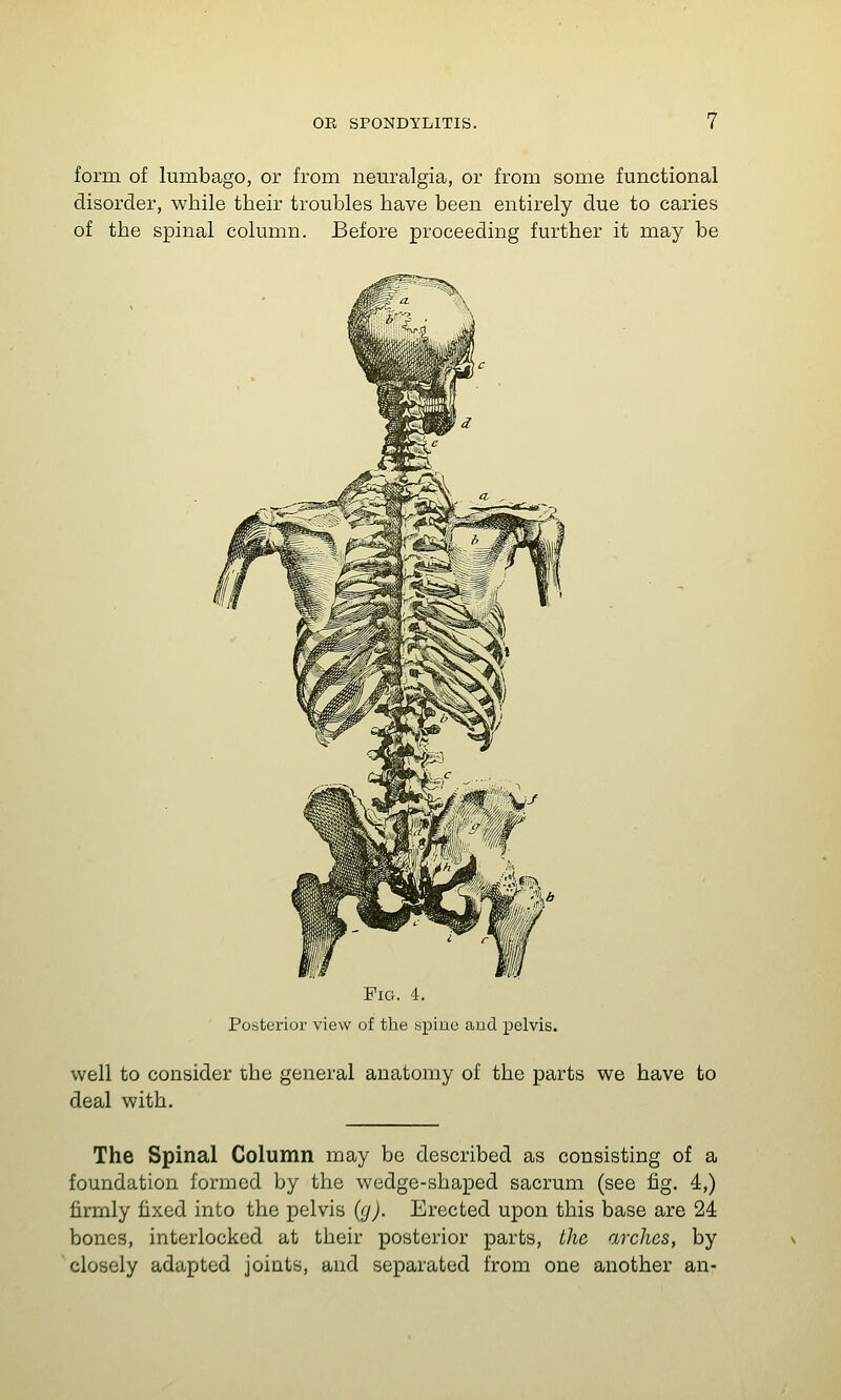 form of lumbago, or from nem'algia, or from some functional disorder, while their troubles have been entirely due to caries of the spinal column. Before proceeding further it may be Fig. 4. Posterior view of the spine aud pelvis. well to consider the general anatomy of the parts we have to deal with. The Spinal Column may be described as consisting of a foundation formed by the wedge-shaped sacrum (see fig. 4,) firmly fixed into the pelvis ((j). Erected upon this base are 24 bones, interlocked at their posterior parts, the arches, by closely adapted joiats, and separated from one another an-