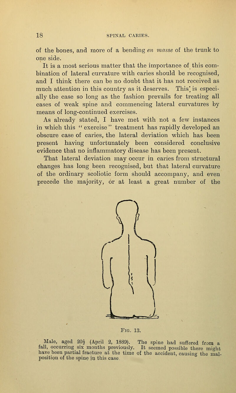 of the bones, and more of a bending en masse of the trmik to one side. It is a most serious matter that the importance of this com- bination of lateral curvature with caries should be recognised, and I think there can be no doubt that it has not received as much attention in this country as it deserves. This' is especi- ally the case so long as the fashion prevails for treating all cases of weak spine and commencing lateral curvatures by means of long-continued exercises. As already stated, I have met with not a few instances in which this  exercise  treatment has rapidly developed an obscure case of caries, the lateral deviation which has been present having unfortunately been considered conclusive evidence that no inflammatory disease has been present. That lateral deviation may occur in caries from structural changes has long been recognised, but that lateral curvature of the ordinary scoliotic form should accompany, and even precede the majority, or at least a great number of the Fig. 13. Male, aged 20^ (April 2, 1889). The spine had suffered from a fall, occurring six months previously. It seemed possible there might have been partial fracture at the time of the accident, causing the mal- positign of the spine iii this case.