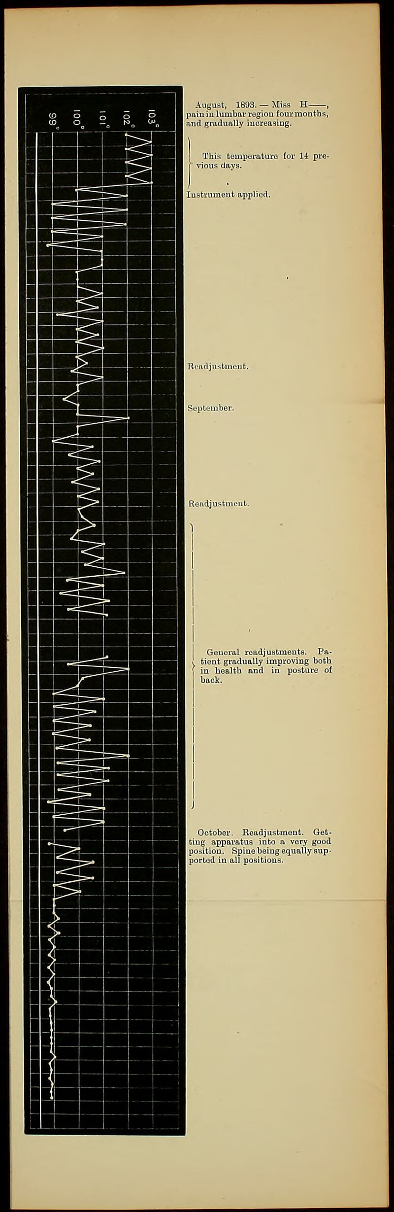 W^^M August, 1893. —Miss H , painialumbni-regiou fourmonths, aud graduivUy increasing. 1 This temperature for 14 pre- 1 vious days. Si.-pt ember. 1 11 II H 1 Reiidjustmeut. 1 1 1 1 1 1 1 , Geuoi-al readjuBtments. Pa- tient gradually improving both iu health and in posture of back. 1 1 ^^^^^^B ^^^^^^H ^^^B J October. Roadjuatmont. Get- position. Spino being equally aup- [lortod in all positions. Hh Hb IK IBB IBB HI Hj