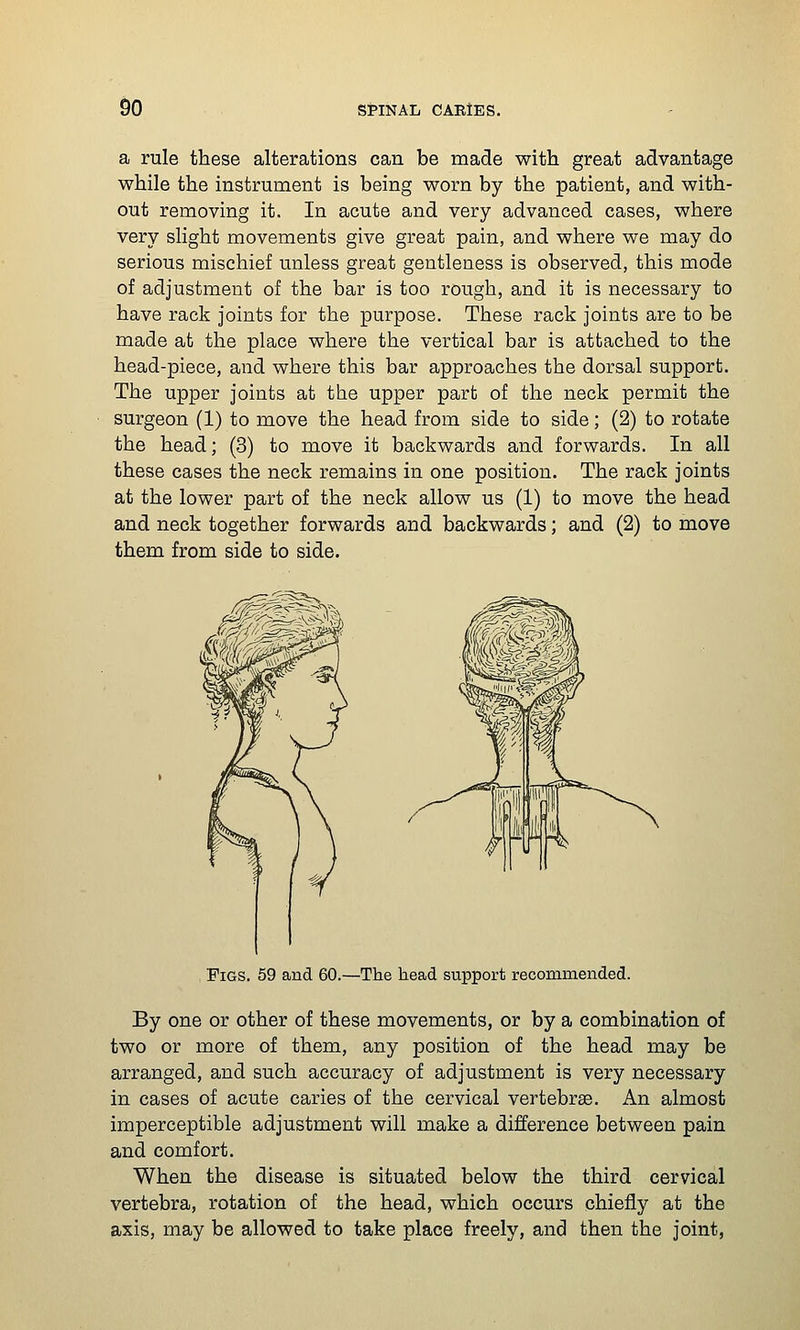 a rule these alterations can be made with great advantage while the instrument is being worn by the patient, and with- out removing it. In acute and very advanced cases, where very slight movements give great pain, and where we may do serious mischief unless great gentleness is observed, this mode of adjustment of the bar is too rough, and it is necessary to have rack joints for the purpose. These rack joints are to be made at the place where the vertical bar is attached to the head-piece, and where this bar approaches the dorsal support. The upper joints at the upper part of the neck permit the surgeon (1) to move the head from side to side; (2) to rotate the head; (3) to move it backwards and forwards. In all these cases the neck remains in one position. The rack joints at the lower part of the neck allow us (1) to move the head and neck together forwards and backwards; and (2) to move them from side to side. Pigs. 59 and 60.—The head support recommended. By one or other of these movements, or by a combination of two or more of them, any position of the head may be arranged, and such accuracy of adjustment is very necessary in cases of acute caries of the cervical vertebrae. An almost imperceptible adjustment will make a difference between pain and comfort. When the disease is situated below the third cervical vertebra, rotation of the head, which occurs chiefly at the axis, may be allowed to take place freely, and then the joint,