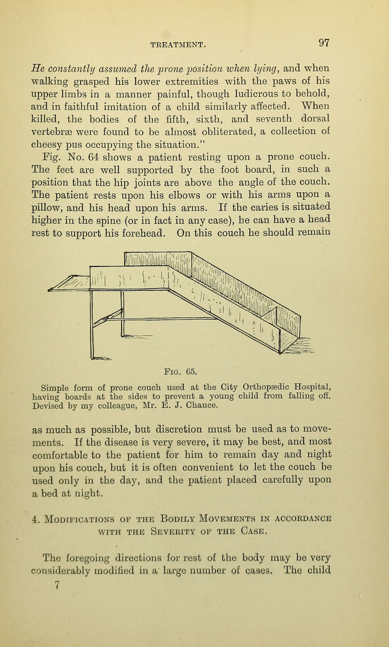 He constantly assumed the 'prone ijosition tvhen lying, and when walking grasped his lower extremities with the paws of his upper limbs in a manner painful, though ludicrous to behold, and in faithful imitation of a child similarly affected. When killed, the bodies of the fifth, sixth, and seventh dorsal vertebrae were found to be almost obliterated, a collection of cheesy pus occupying the situation. Fig. No. 64 shows a patient resting upon a prone couch. The feet are well supported by the foot board, in such a position that the hip joints are above the angle of the couch. The patient rests upon his elbows or with his arms upon a pillow, and his head upon his arms. If the caries is situated higher in the spine (or in fact in any case), be can have a head rest to support his forehead. On this couch he should remain Fig. 65. Simple form of prone couch used at the City Orthopaedic Hospital, having boards at the sides to prevent a young child from falling off. Devised by my colleague, Mr. E. J. Chance. as much as possible, but discretion must be used as to move- ments. If the disease is very severe, it may be best, and most comfortable to the patient for him to remain day and night upon his couch, but it is often convenient to let the couch be used only in the day, and the patient placed carefully upon a bed at night. 4. Modifications of the Bodily Movements in accordance WITH THE Severity of the Case. The foregoing directions for rest of the body may be very considerably modified in a large number of cases. The child 7