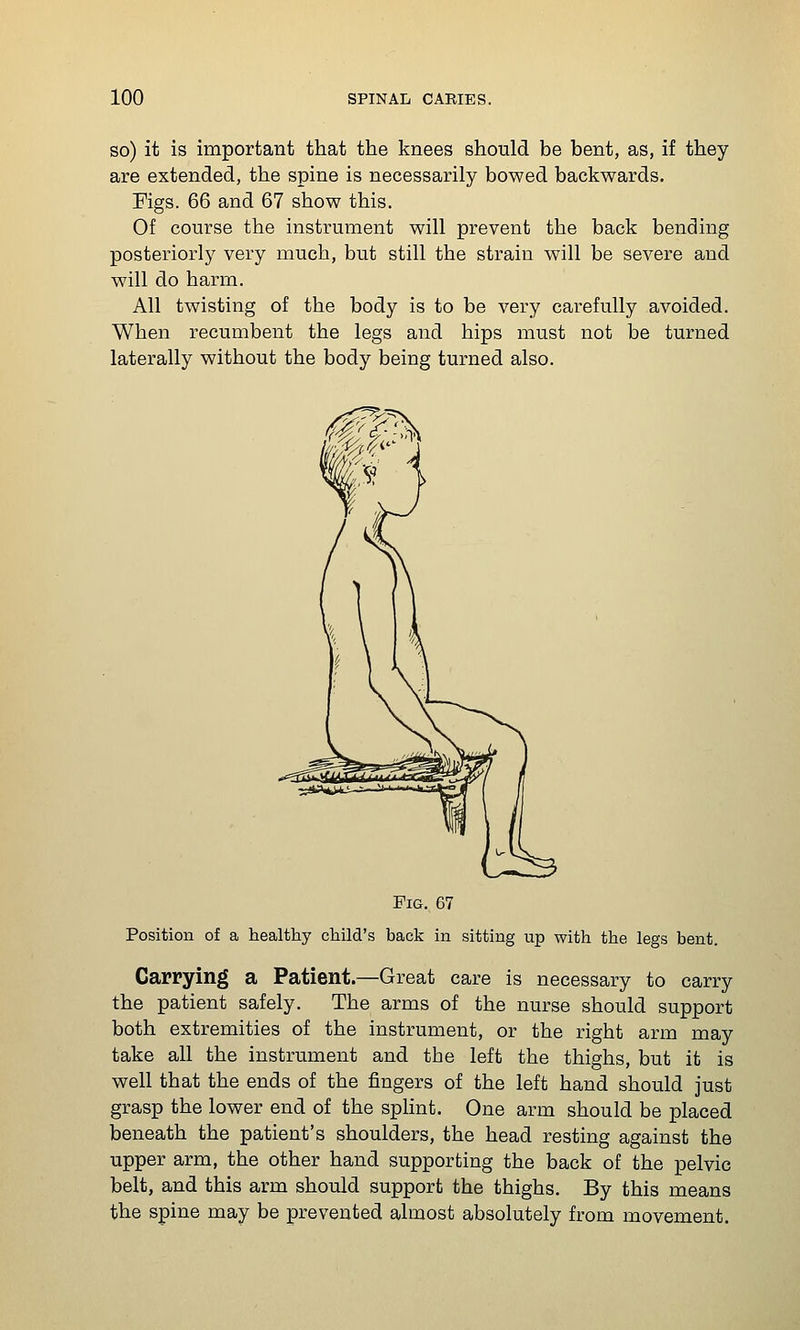 so) it is important that the knees should be bent, as, if they are extended, the spine is necessarily bowed backwards. Figs. 66 and 67 show this. Of course the instrument will prevent the back bending posteriorly very much, but still the strain will be severe and will do harm. All twisting of the body is to be very carefully avoided. When recumbent the legs and hips must not be turned laterally without the body being turned also. Fig. 67 Position of a healthy child's back in sitting up with the legs bent. Carrying a Patient.—Great care is necessary to carry the patient safely. The arms of the nurse should support both extremities of the instrument, or the right arm may take all the instrument and the left the thighs, but it is well that the ends of the fingers of the left hand should just grasp the lower end of the splint. One arm should be placed beneath the patient's shoulders, the head resting against the upper arm, the other hand supporting the back of the pelvic belt, and this arm should support the thighs. By this means the spine may be prevented almost absolutely from movement.