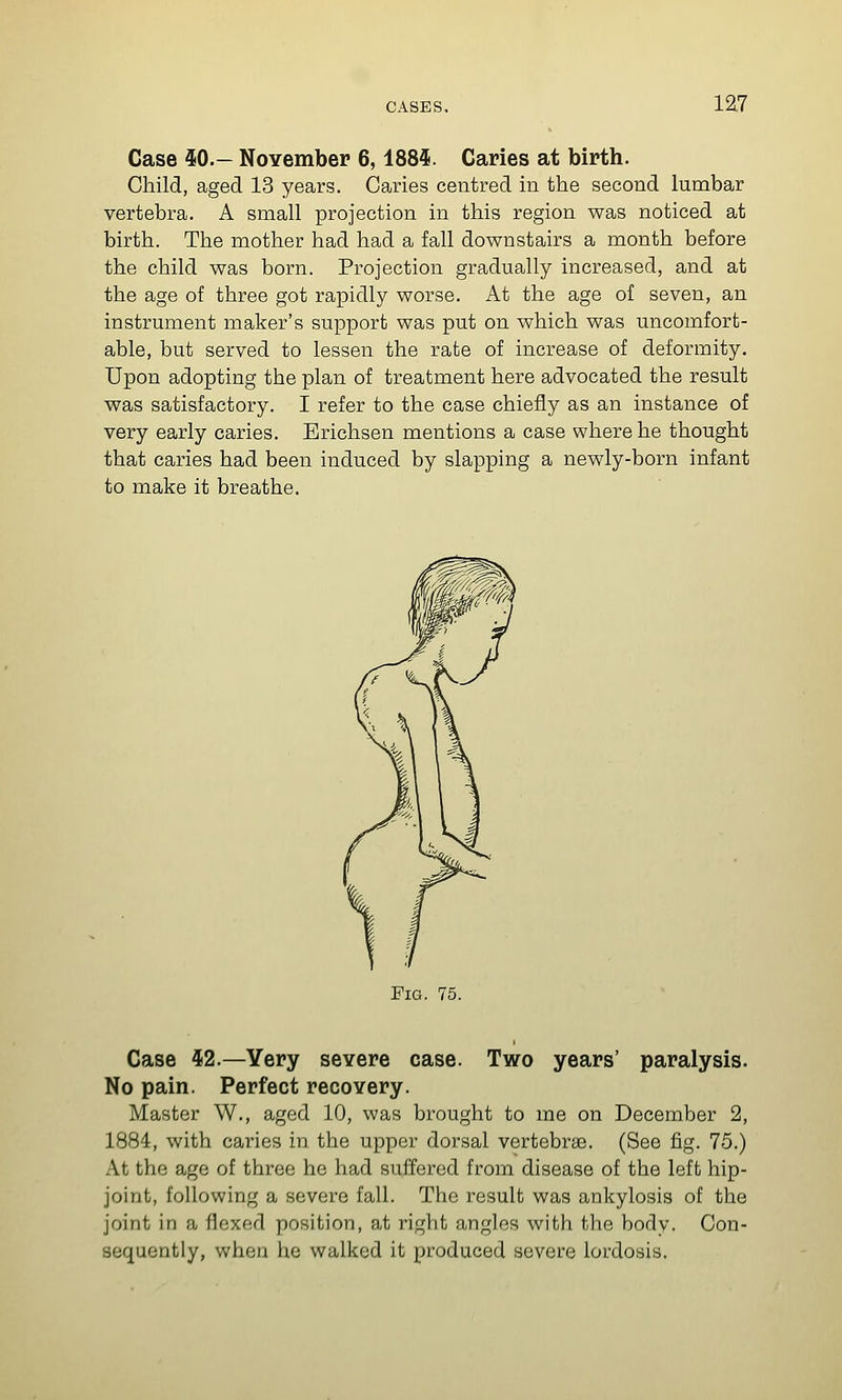 Case iO.- NoYember 6,1885. Caries at birth. Child, aged 13 years. Caries centred in the second lumbar vertebra. A small projection in this region was noticed at birth. The mother had had a fall downstairs a month before the child was born. Projection gradually increased, and at the age of three got rapidly worse. At the age of seven, an instrument maker's support was put on which was uncomfort- able, but served to lessen the rate of increase of deformity. Upon adopting the plan of treatment here advocated the result was satisfactory. I refer to the case chiefly as an instance of very early caries. Brichsen mentions a case where he thought that caries had been induced by slapping a newly-born infant to make it breathe. Pig. 75. Case 42.—Yery severe case. Two years' paralysis. No pain. Perfect recovery. Master W., aged 10, was brought to me on December 2, 1884, with caries in the upper dorsal vertebrae. (See fig. 75.) At the age of three he had suffered from disease of the left hip- joint, following a severe fall. The result was ankylosis of the joint in a flexed position, at right angles with the body. Con- sequently, when he walked it produced severe lordosis.