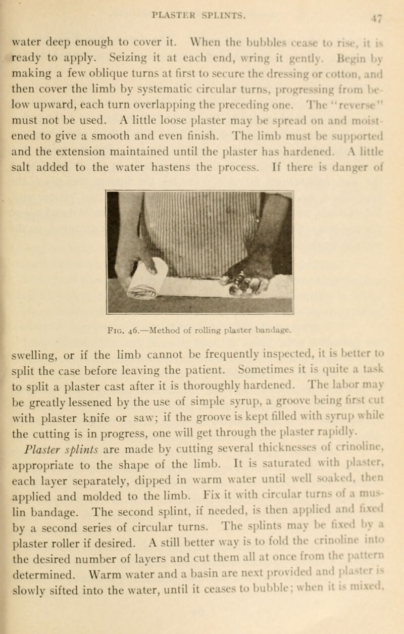 water deep enough t<> cover it. When the bubble ready to apply. Seizing it at each end, wring it gently. B making a few oblique turns at tir-t to se< ure the dressing <t «otton then cover the limb by systemati< i ircular turns, pr low upward, each turn overlapping the preceding one. Th< must not be used. A little loose plaster may be spread on and n ened to give a smooth and even finish. The limb must be supp and the extension maintained until the plaster has hardened. \ little salt added to the water hastens the process. If there is dang IV I I I ililli *fth 1'' ill Hi ^ iiilliiMiiiliH FlG. 46. — Method of rolling plasti ■ swelling, or if the limb cannot be frequently inspected, it is better to split the case before leaving the patient. Sometime- it is quite to split a plaster cast after it is thoroughly hardened. The labor may be .^reatlylessened by the use of simple syrup, .1 groove being fii with plaster knife or saw; if the groove is kept filled with syrup while the cutting is in progress, one will get through the plaster rapidly. Plaster splints are made by cutting several thicknesses of crinoline, appropriate to the shape of the limb. It is saturated with pi each layer separately, dipped in warm water until well soaked, then applied and molded to the limb. Fix it with circular turn- of a mus Lin bandage. The second splint, if needed, is then applied and by a second series of circular turns. The splints may be I plaster roller if desired. A still better way is to fold the < rinoline i the desired number of layers and cut them all at once from the | determined. Warm water and a basin are next provided ai slowly sifted into the water, until it ceases to bubble; when it