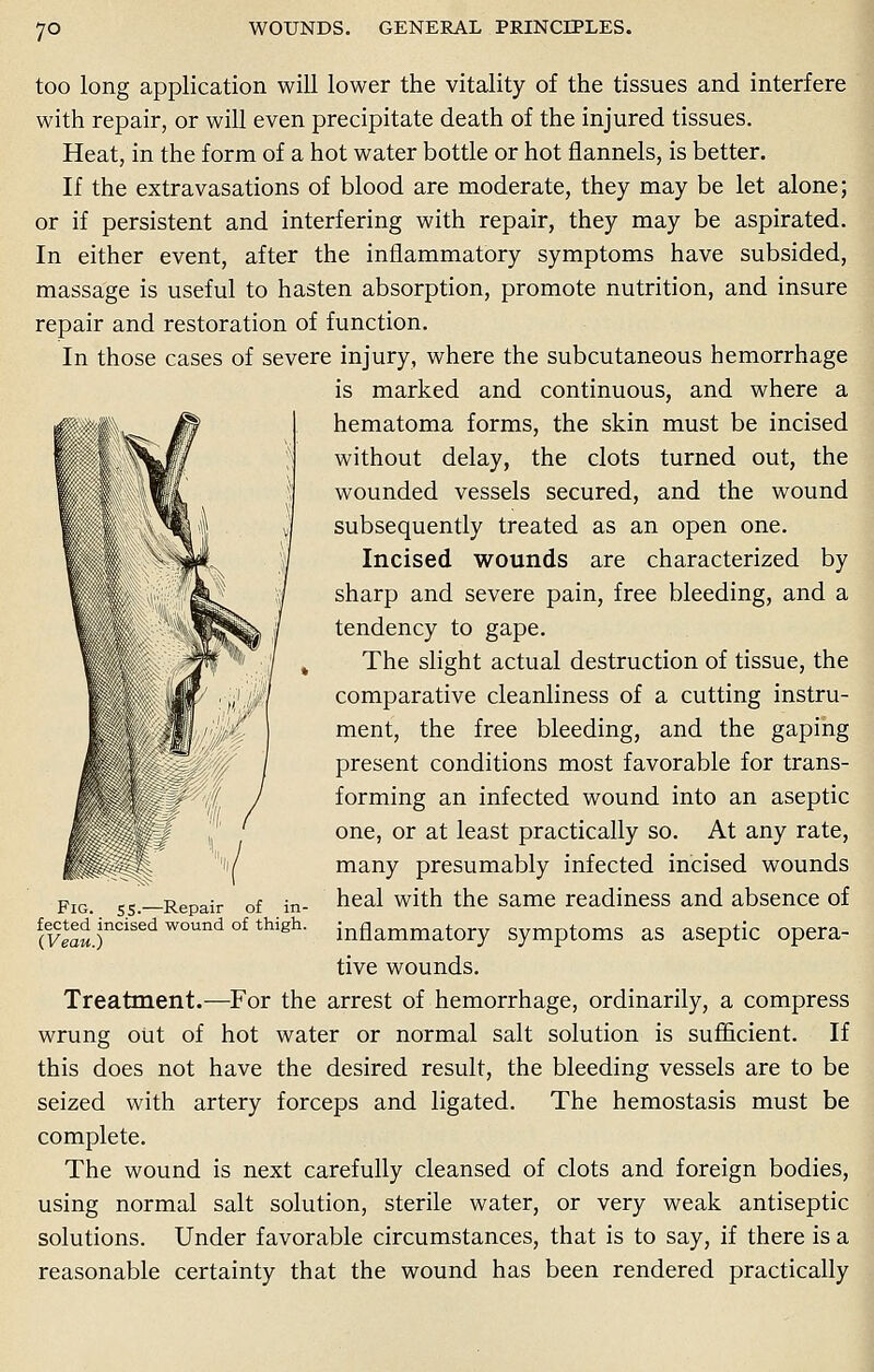 7° too long application will lower the vitality of the tissues and interfere with repair, or will even precipitate death of the injured tissues. Heat, in the form of a hot water bottle or hot flannels, is better. If the extravasations of blood are moderate, they may be let alone; or if persistent and interfering with repair, they may be aspirated. In either event, after the inflammatory symptoms have subsided, massage is useful to hasten absorption, promote nutrition, and insure repair and restoration of function. In those cases of severe injury, where the subcutaneous hemorrhage is marked and continuous, and where a hematoma forms, the skin must be incised without delay, the clots turned out, the wounded vessels secured, and the wound subsequently treated as an open one. Incised wounds are characterized by sharp and severe pain, free bleeding, and a tendency to gape. The slight actual destruction of tissue, the comparative cleanliness of a cutting instru- ment, the free bleeding, and the gaping present conditions most favorable for trans- forming an infected wound into an aseptic one, or at least practically so. At any rate, many presumably infected incised wounds heal with the same readiness and absence of inflammatory symptoms as aseptic opera- tive wounds. Treatment.—For the arrest of hemorrhage, ordinarily, a compress wrung out of hot water or normal salt solution is sufficient. If this does not have the desired result, the bleeding vessels are to be seized with artery forceps and ligated. The hemostasis must be complete. The wound is next carefully cleansed of clots and foreign bodies, using normal salt solution, sterile water, or very weak antiseptic solutions. Under favorable circumstances, that is to say, if there is a reasonable certainty that the wound has been rendered practically Fig. 55.—Repair of in fected incised wound of thigh (Veau.)