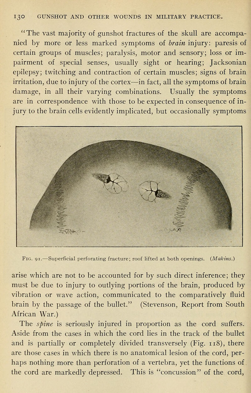 The vast majority of gunshot fractures of the skull are accompa- nied by more or less marked symptoms of brain injury: paresis of certain groups of muscles; paralysis, motor and sensory; loss or im- pairment of special senses, usually sight or hearing; Jacksonian epilepsy; twitching and contraction of certain muscles; signs of brain irritation, due to injury of the cortex—in fact, all the symptoms of brain damage, in all their varying combinations. Usually the symptoms are in correspondence with those to be expected in consequence of in- jury to the brain cells evidently implicated, but occasionally symptoms Fig. 91.—Superficial perforating fracture; roof lifted at both openings. (Makins.) arise which are not to be accounted for by such direct inference; they must be due to injury to outlying portions of the brain, produced by vibration or wave action, communicated to the comparatively fluid brain by the passage of the bullet. (Stevenson, Report from South African War.) The spine is seriously injured in proportion as the cord suffers. Aside from the cases in which the cord lies in the track of the bullet and is partially or completely divided transversely (Fig. 118), there are those cases in which there is no anatomical lesion of the cord, per- haps nothing more than perforation of a vertebra, yet the functions of. the cord are markedly depressed. This is concussion of the cord,