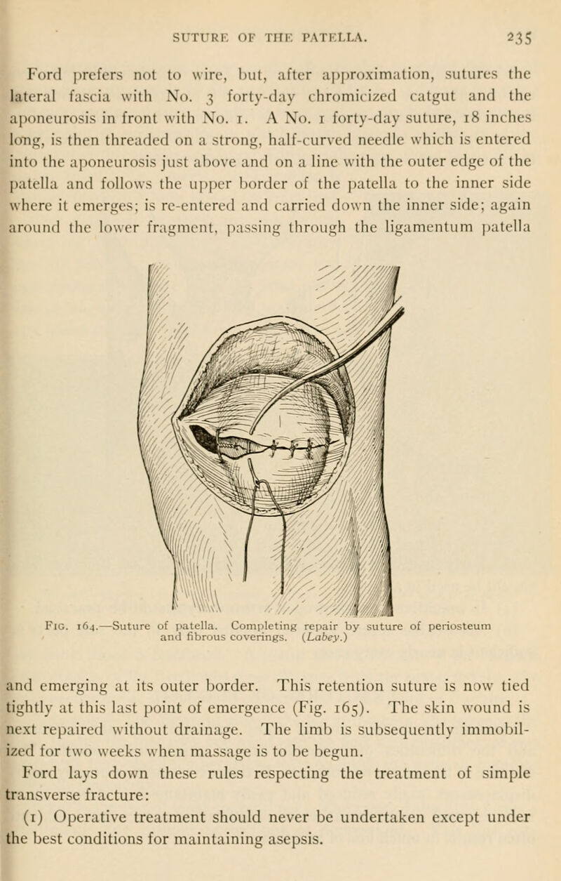 SUTl'Ki OF nil PAT! l LA. *35 Ford prefers not to wire, but, after approximation, sutures the lateral fascia with No. 3 forty day chromicized catgut and the aponeurosis in front with No. 1. A No. 1 forty-day suture, 18 inches long, is then threaded on a Strong, half curved needle which is entered into the aponeurosis just above and on a line with the outer edge of the patella and follows the upper border of the patella to the inner side where it emerges; is re entered and carried down the inner side; again around the lower fragment, passing through the ligamentum patella Fig. 16.1.—Suture of patella. Completing repair by suture of periosteum and fibrous coverings. (Labey.) and emerging at its outer border. This retention suture is now tied tightly at this last point of emergence (Fig. 165). The skin wound is next repaired without drainage. The limb is subsequently immobil- ized for two weeks when massage is to be begun. Ford lays down these rules respecting the treatment of simple transverse fracture: (1) Operative treatment should never be undertaken except under the best conditions for maintaining asepsis.