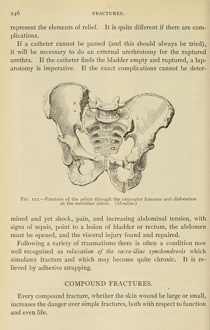 represent the elements of relief. It is quite different if there are com- plications. If a catheter cannot be passed (and this should always be tried), it will be necessary to do an external urethrotomy for the ruptured urethra. If the catheter finds the bladder empty and ruptured, a lap- arotomy is imperative. If the exact complications cannot be deter- Fig. 177.—Fracture of the pelvis through the obturator foramen and dislocation at the sacroiliac joints. (Moullin.) mined and yet shock, pain, and increasing abdominal tension, with signs of sepsis, point to a lesion of bladder or rectum, the abdomen must be opened, and the visceral injury found and repaired. Following a variety of traumatisms there is often a condition now well recognized as relaxation of the sacro-iliac synchondrosis which simulates fracture and which may become quite chronic. It is re- lieved by adhesive strapping. COMPOUND FRACTURES. Every compound fracture, whether the skin wound be large or small, increases the danger over simple fractures, both with respect to function and even life.