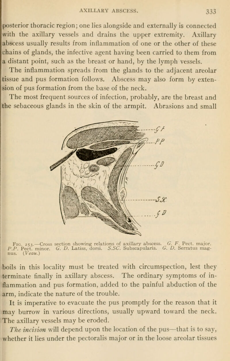 posterior thoracic region; one Lies alongside and externally is connc ted with the axillary vessels and drains the upper extremity. Axillary ftbscess usually results from inflammation <>f one or the other of these chains of glands, the infective agent having been carried to them from a distant point, such as the breast or hand, by the lymph vessels. The inflammation spreads from the glands to the adjacent areolar tissue and pus formation follows. Abscess may also form by exten- sion of pus formation from the base of the neck. The most frequent sources of infection, probably, are the breast and the sebaceous glands in the skin of the armpit. Abrasions and small Pig »S3. Cross section showing relations of axillary abscess. G. F. Pect. major. P.P. Feet, minor. G. D. Latiss, dorsi. S.SC. Subscapularis. G. D. Serratus mag- nus. (Veau.) boils in this locality must be treated with circumspection, lest they terminate finally in axillary abscess. The ordinary symptoms of in- flammation and pus formation, added to the painful abduction of the arm, indicate the nature of the trouble. It is imperative to evacuate the pus promptly for the reason that it pay burrow in various directions, usually upward toward the neck. Tin- axillary vessels may be eroded. The incision will depend upon the location of the pus thai is to say, whether it lies under the pectoralis major or in the loose areolar tissues