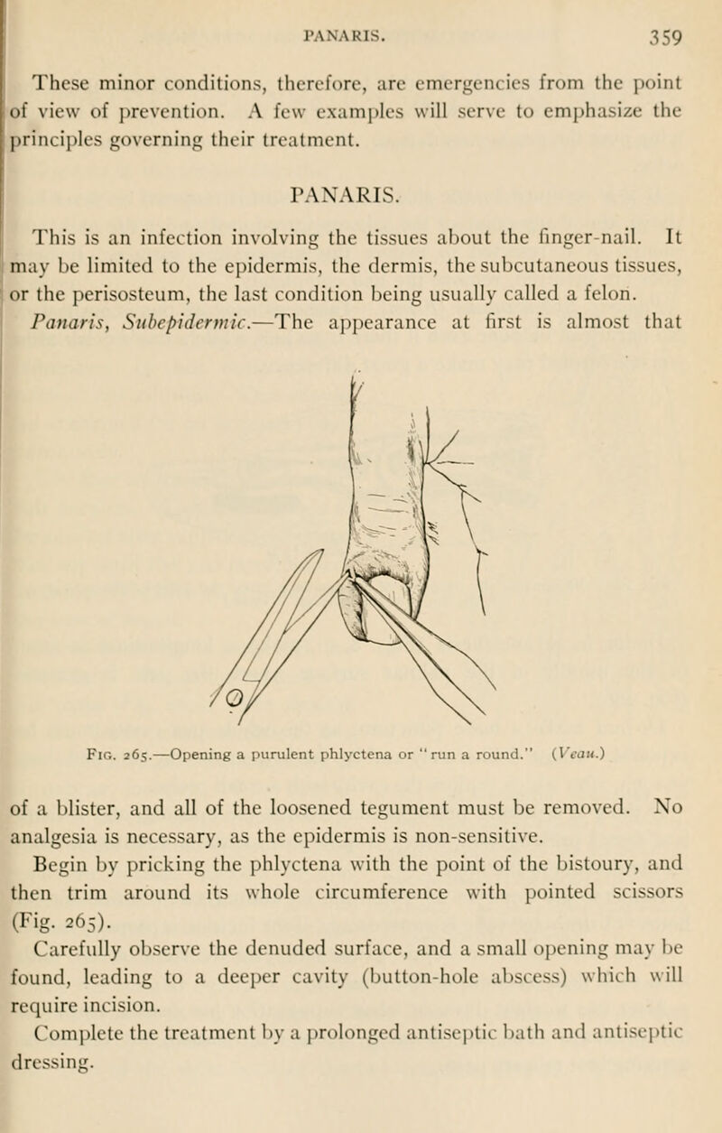 These minor conditions, therefore, are emergencies from the point of view of prevention. A few examples will serve to emphasize tin- principles governing their treatment. PANARIS. This is an infection involving the tissues about the finger-nail. It may he limited to the epidermis, the dermis, the subcutaneous tissues, or the perisosteum, the last condition being usually called a felon. Panaris, Subcpidcnnic.—The appearance at first is almost that Fir.. 265.—Opening a purulent phlyctena or run a round. (lYii/i.) of a blister, and all of the loosened tegument must be removed. No analgesia is necessary, as the epidermis is non-sensitive. Begin by pricking the phlyctena with the point of the bistoury, and then trim around its whole circumference with pointed scissors (Fig. 265). Carefully observe the denuded surface, and a small opening may be found, leading to a deeper cavity (button-hole abscess) which will require incision. Complete the treatment by a prolonged antiseptic bath and antiseptic dressing.