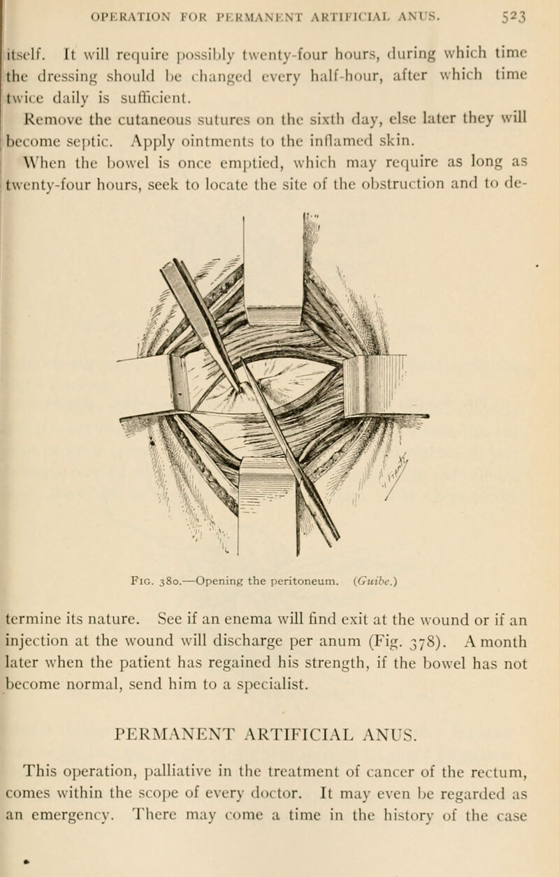 ■self. It will require possibly twenty four hours, during which time the dressing should be changed every half-hour, after which time twi< i- daily is sufficient. Remove the cutaneous sutures on the sixth day, else later they will become septic. Apply ointments to the inflamed skin. When the bowel is once emptied, which may require as long as twenty-four hours, seek to locate the site of the obstruction and to de Fig. 380.—Opening the peritoneum. (Guide.) ermine its nature. See if an enema will find exit at the wound or if an injection at the wound will discharge per anum (Fig. 378). A month later when the patient has regained his strength, if the bowel has not become normal, send him to a specialist. PERMANENT ARTIFICIAL ANUS. This operation, palliative in the treatment of cancer of the rectum, pomes within the scope of every doctor. It may even be regarded as an emergency. There may come a time in the history of the case