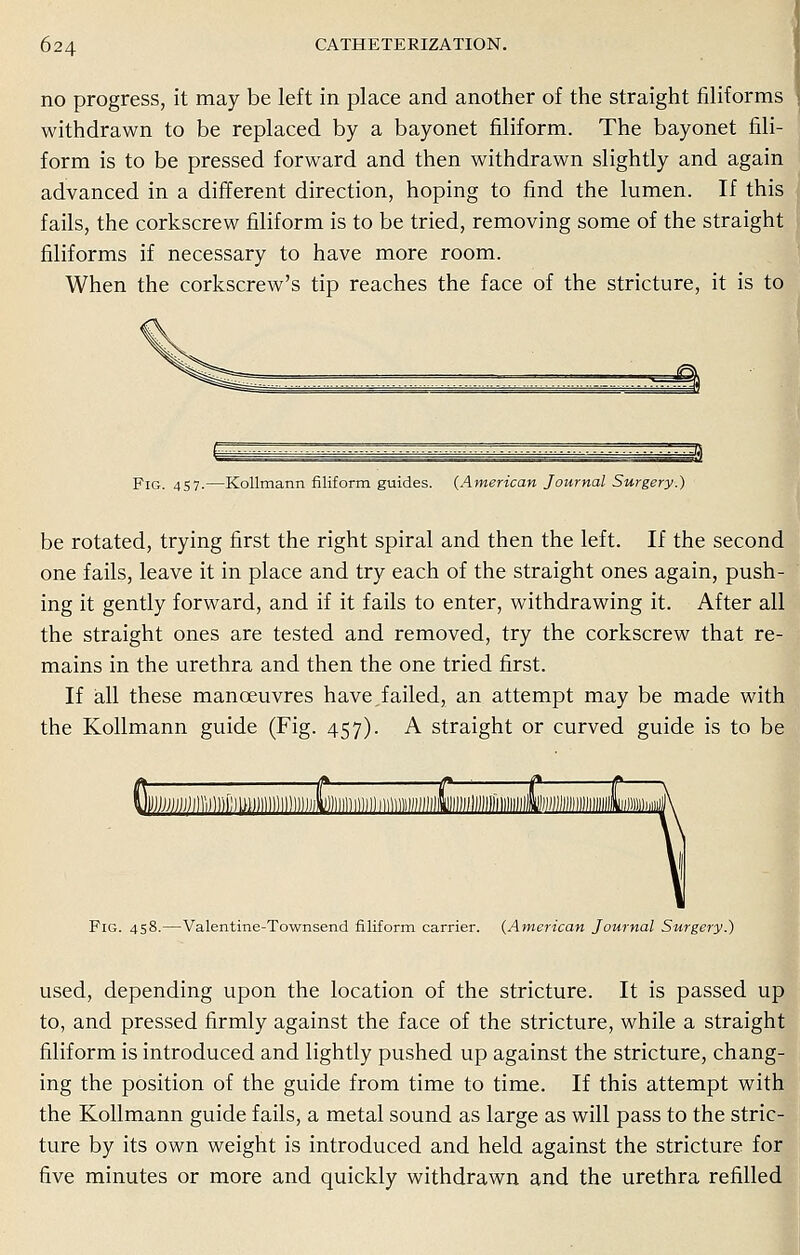 no progress, it may be left in place and another of the straight filiforms withdrawn to be replaced by a bayonet filiform. The bayonet fili- form is to be pressed forward and then withdrawn slightly and again advanced in a different direction, hoping to find the lumen. If this fails, the corkscrew filiform is to be tried, removing some of the straight filiforms if necessary to have more room. When the corkscrew's tip reaches the face of the stricture, it is to Fig. 457.—Kollmann filiform guides. (American Journal Surgery.) be rotated, trying first the right spiral and then the left. If the second one fails, leave it in place and try each of the straight ones again, push- ing it gently forward, and if it fails to enter, withdrawing it. After all the straight ones are tested and removed, try the corkscrew that re- mains in the urethra and then the one tried first. If all these manoeuvres have,failed, an attempt may be made with the Kollmann guide (Fig. 457). A straight or curved guide is to be Fig. 458.—Valentine-Townsend filiform carrier. {American Journal Surgery.) used, depending upon the location of the stricture. It is passed up to, and pressed firmly against the face of the stricture, while a straight filiform is introduced and lightly pushed up against the stricture, chang- ing the position of the guide from time to time. If this attempt with the Kollmann guide fails, a metal sound as large as will pass to the stric- ture by its own weight is introduced and held against the stricture for five minutes or more and quickly withdrawn and the urethra refilled