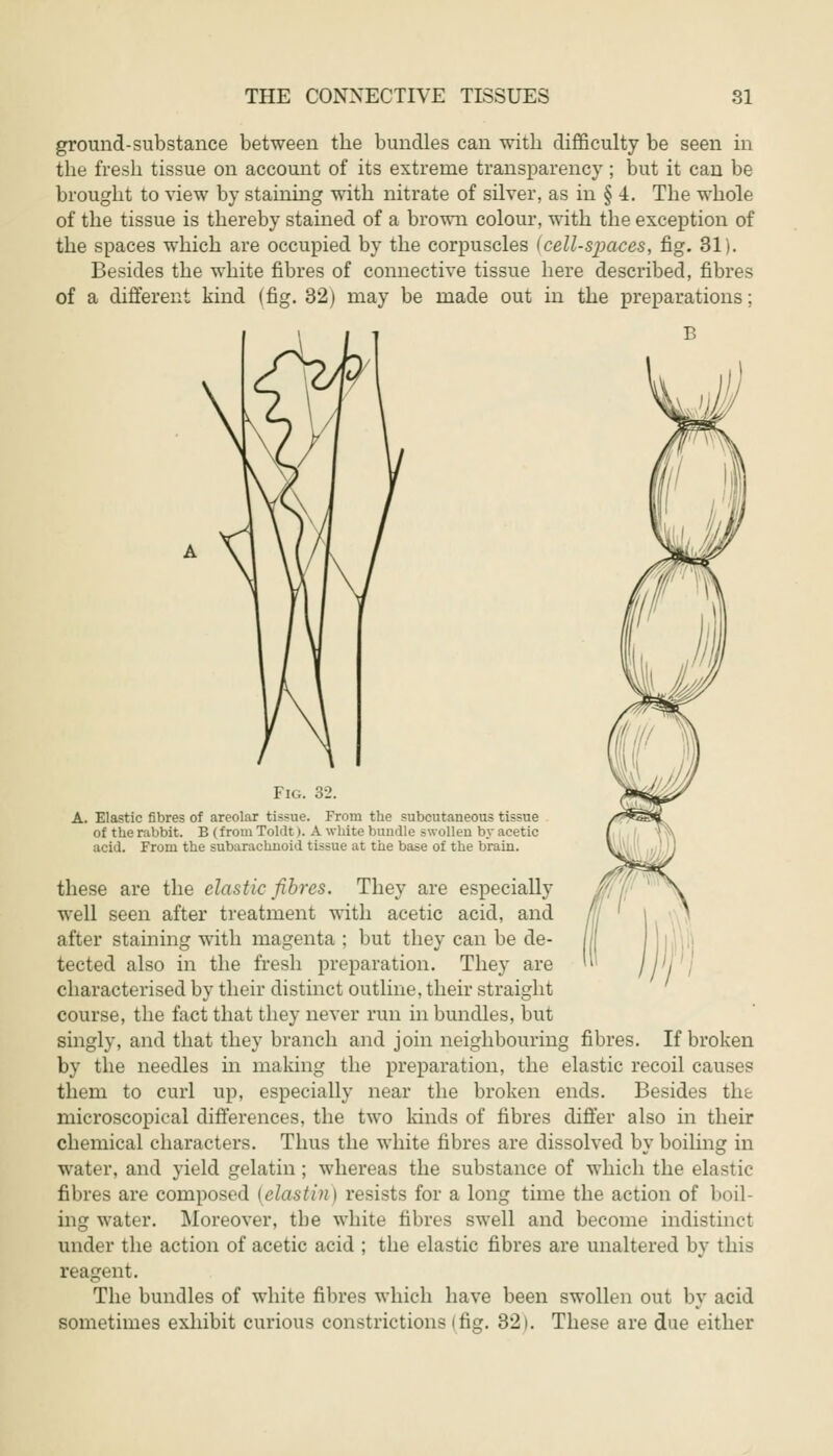 ground-substance between the bundles can with difficulty be seen in the fresh tissue on account of its extreme transparency ; but it can be brought to view by staining with nitrate of silver, as in § 4. The whole of the tissue is thereby stained of a brown colour, with the exception of the spaces which are occupied by the corpuscles (cell-spaces, fig. 31). Besides the white fibres of connective tissue here described, fibres of a different kind (fig. 32) may be made out in the preparations; Fig. 32. A. Elastic fibres of areolar tissue. From the subcutaneous tissue of the rabbit. B (from ToMt >. A white lmn<lle swollen by acetic acid. From the subarachnoid tissue at the base of the brain. these are the clastic fibres. They are especially well seen after treatment with acetic acid, and after staining with magenta ; but they can be de- tected also in the fresh preparation. They are characterised by their distinct outline, their straight course, the fact that they never run in bundles, but singly, and that they branch and join neighbouring fibres. If broken by the needles hi making the preparation, the elastic recoil causes them to curl up, especially near the broken ends. Besides the microscopical differences, the two kinds of fibres differ also in their chemical characters. Thus the white fibres are dissolved by boiling in water, and yield gelatin ; whereas the substance of which the elastic fibres are composed (elastin) resists for a long time the action of boil- ing water. Moreover, the white fibres swell and become indistinct under the action of acetic acid ; the elastic fibres are unaltered by this reagent. The bundles of white fibres which have been swollen out by acid sometimes exhibit curious constrictions (fig. 321. These are due either