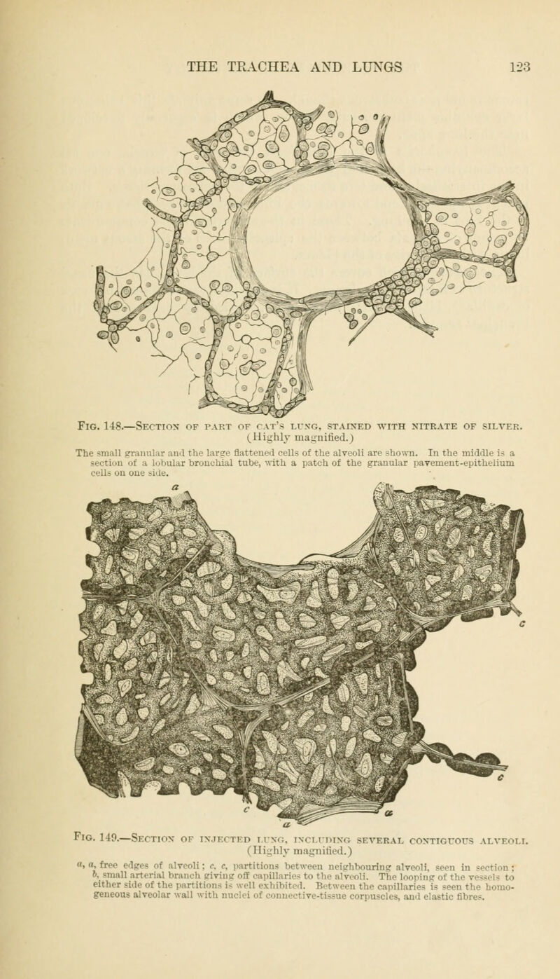 Fig. 148.—Section- of tart of cat's lung, stained with nitrate of silver. (Highly magnified.) The small granular and the large Battened cells of the alveoli are shown. In the middle is a i] i a Lobular bronchial tube, with a patch of the granular pavement-epithelium on one side. Fig. 149.—Section of injected lung, including several contiguous alveoli. I Highly magnified.) , n, free edges of alveoli; c, c partitions ; ghbouring alveoli, seen in section; ■' arterial branch giving off capillaries - either side oi el] exhibited. geueous alveolar wall with nuclei of connective-tissue corpuscles, and elastic fibres.