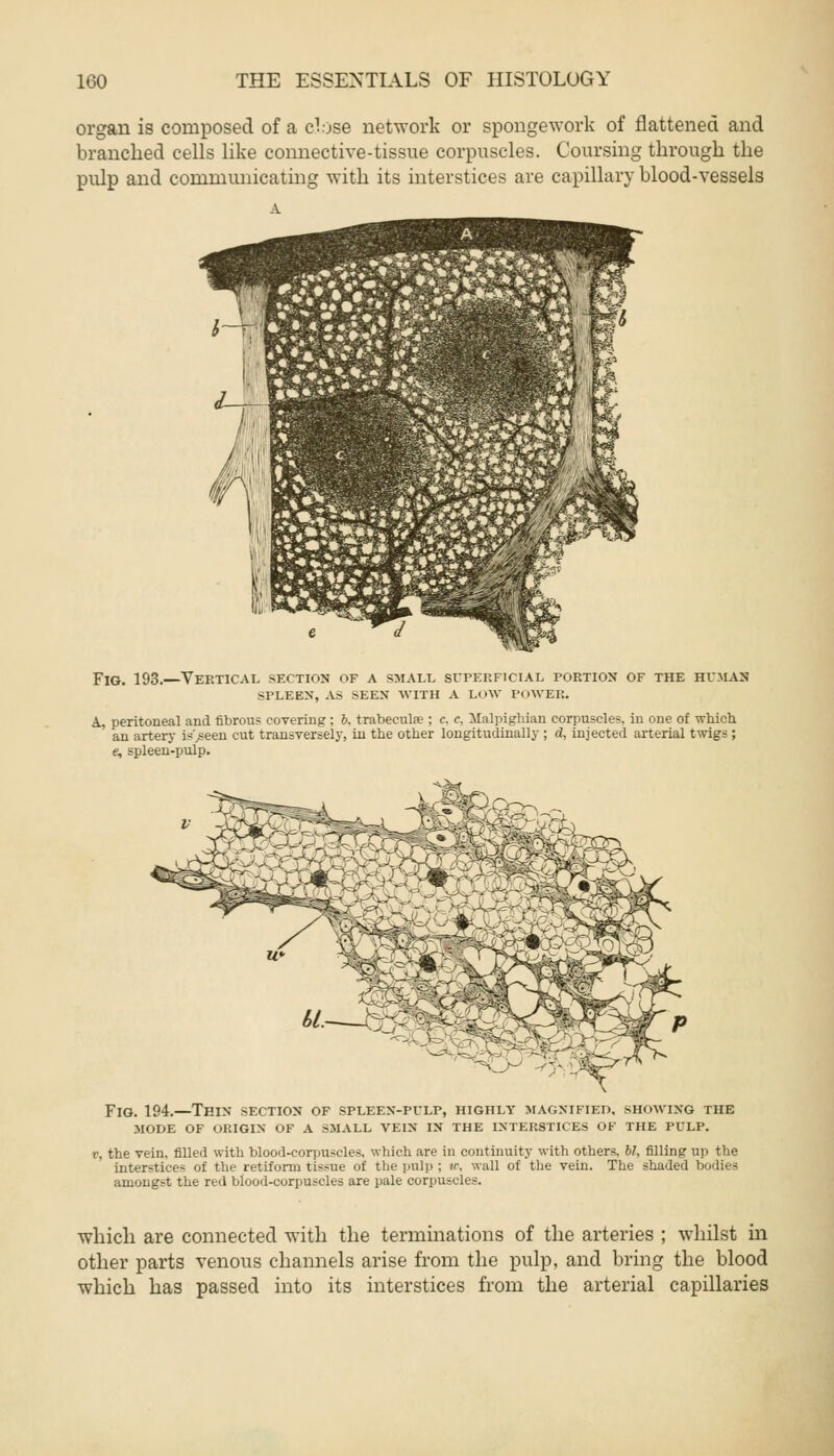 organ is composed of a close network or sponge work of flattened and branched cells like connective-tissue corpuscles. Coursing through the pulp and communicating with its interstices are capillary blood-vessels Fig. 193.—Vertical section of a small superficial portion of the human SPLEEN, AS SEEN WITH A Low POWER. A, peritoneal and fibrous covering ; 6, trabecular; c. c, Malpighian corpuscle?, in one of which an artery is>een cut transversely, in the other longitudinally ; d, injected arterial twigs ; «, spleen-pulp. Fig. 194.—Thin section of spleen-pulp, highly magnified, showing the mode of origin of a small vein in the interstices of the pulp. r, the vein, filled with blood-corpuscles, which are in continuity with others, W, filling up the interstices of the retiform tissue of the pulp ; w, wall of the vein. The shaded bodies amongst the red blood-corpuscles are pale corpuscles. which are connected with the terminations of the arteries ; whilst in other parts venous channels arise from the pulp, and bring the blood which has passed into its interstices from the arterial capillaries