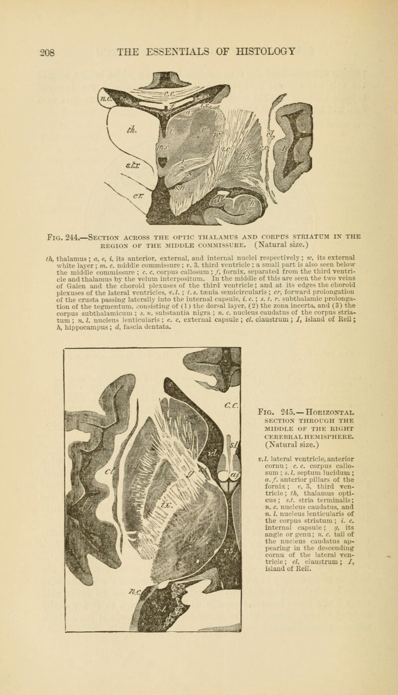 Fig. 244.—Section across the optic thalamus and corpus striatum in the region of the middle commissure. (Natural size.) th, thalamus; a, e, i, its anterior, external, and internal nuclei respectively ; tc, its external white laver; m. c. middle commissure; v. 3. third ventricle ; a small part is also seen below the middle commissure ; c. e. corpus callosum ; /', fornix, separated from the third ventri- cle and thalamus by the velum interpositum. In the middle of this are seen the two veins of Galen and the choroid plexuses of the third ventricle; and at its edges the choroid plexuses of the lateral ventricles, v. I. : t.s. taenia semicircularis ; cr, forward prolongation of the crusta passing laterally into the internal capsule, i. c.; s. t. r. subthalamic prolonga- tion of the tegmentum, consisting of (1) the dorsal layer, (2) the zona incerta, and (3) the corpus subthalamicum ; «. ti. substantia nigra ; n. c. nucleus caudatus of the corpus stria- tum ; n. I. nucleus lenticularis ; <?. c. external capsule ; cl. claustrum ; /, island of Keil; h, hippocampus ; d, fascia dentata. Fig. 245.—Horizontal section through the middle of the right cerebral hemisphere. (Natural size.) v.I. lateral ventricle, anterior cornu ; c. c. corpus callo- sum : s. 1. septum lucidum ; a./, anterior pillars of the fornix; v. 3, third ven- tricle ; th, thalamus opti- cus; s.t. stria terminalis; n. c. nucleus caudatus, and 7i. I. nucleus lenticularis of the corpus striatum : i. c. internal capsule: g, its angle or genu; ». c. tail of the nnc ens caudatus ap- pearing in the descending cornu of the lateral ven- tricle ; cl, claustrum; /, island of Reil.