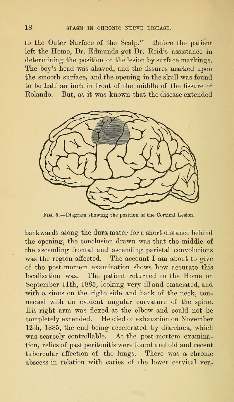 to the Outer Surface of the Scalp. Before the patient left the Home, Dr. Edmunds got Dr. Reid's assistance in determining the position of the lesion by surface markings. The boy's head wats shaved, and the fissures marked upon the smooth surface, and the opening in the skull was found to be half an inch in front of the middle of the fissure of Rolando. But, as it was known that the disease extended Fi&. 5.—Diagram showing the position of the Cortical Lesion. backwards along the dura mater for a short distance behind the opening, the conclusion drawn was that the middle of the ascending frontal and ascending parietal convolutions was the region affected. The account I am about to give of the post-mortem examination shows how accurate this localisation was. The patient returned to the Home on September 11th, 1885, looking very ill and emaciated, and with a sinus on the right side and back of the neck, con- nected with an evident angular curvature of the spine. His right arm was flexed at the elbow and could not be completely extended. He died of exhaustion on November 12th, 1885, the end being accelerated by diarrhoea, which was scarcely controllable. At the post-mortem examina- tion, relics of past peritonitis were found and old and recent tubercular affection of the lungs. There was a chronic abscess in relation with caries of the lower cervical ver.-