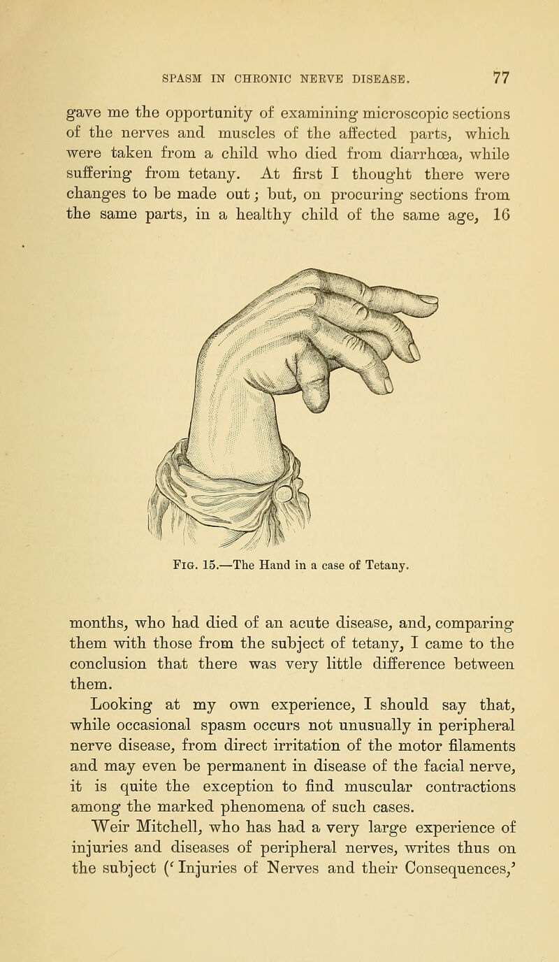 gave me the opportunity of examining microscopic sections of tlie nerves and muscles of the affected parts, which were taken from a child who died from diarrhoea, while suffering from tetany. At first I thought there were changes to be made out; but, on procuring sections from the same parts, in a healthy child of the same age, 16 Fig. 15.—The Hand in a case of Tetany. months, who had died of an acute disease, and, comparing them with those from the subject of tetany, I came to the conclusion that there was very little difference between them. Looking at my own experience, I should say that, while occasional spasm occurs not unusually in peripheral nerve disease, from direct irritation of the motor filaments and may even be permanent in disease of the facial nerve, it is quite the exception to find muscular contractions among the marked phenomena of such cases. Weir Mitchell, who has had a very large experience of injuries and diseases of peripheral nerves, writes thus on the subject (' Injuries of Nerves and their Consequences,'