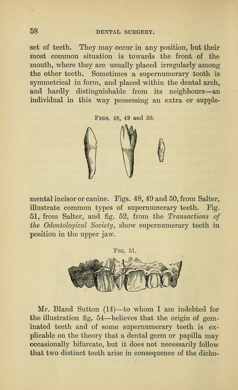 set of teeth. They may occur in any position, but their most common situation is towards the front of the mouth, where they are usually placed irregularly among the other teeth. Sometimes a supernumerary tooth is symmetrical in form, and placed within the dental arch,, and hardly distinguishable from its neighbours—an individual in this way possessing an extra or supple- FiGS. 48, 49 and 50. mental incisor or canine. Figs. 48, 49 and 50, from Salter,, illustrate common types of supernumerary teeth. Fig. 51, from Salter, and fig. 52, from the Transactions of the Odontological Society, show supernumerary teeth in position in the upper jaw. Fig. 51. Mr. Bland Sutton (14)—to whom I am indebted for the illustration fig. 54—believes that the origin of gem- inated teeth and of some supernumerary teeth is ex- plicable on the theory that a dental germ or papilla may occasionally bifurcate, but it does not necessarily follow that two distinct teeth arise in consequence of the dicho-