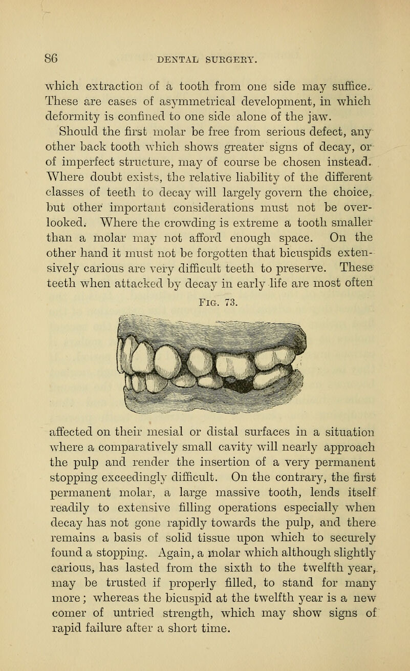 which extraction of a tooth from one side may suffice.. These are cases of asymmetrical development, in which deformity is confined to one side alone of the jaw. Should the first molar be free from serious defect, any other back tooth which shows greater signs of decay, or of imperfect structure, may of course be chosen instead. Where doubt exists, the relative liability of the different classes of teeth to decay will largely govern the choice, but other important considerations must not be over- looked; Where the crowding is extreme a tooth smaller than a molar may not afford enough space. On the other hand it must not be forgotten that bicuspids exten- sively carious are very difficult teeth to preserve. These teeth when attacked by decay in early life are most often Fig. 73. affected on their mesial or distal surfaces in a situation where a comparatively small cavity will nearly approach the pulp and render the insertion of a very permanent stopping exceedingly difficult. On the contrary, the first permanent molar, a large massive tooth, lends itself readily to extensive filling operations especially when decay has not gone rapidly towards the pulp, and there remains a basis of solid tissue upon which to secm-ely found a stopping. Again, a molar which although slightly carious, has lasted from the sixth to the twelfth year, may be trusted if properly filled, to stand for many more; whereas the bicuspid at the twelfth year is a new comer of untried strength, which may show signs of rapid failure after a short time.