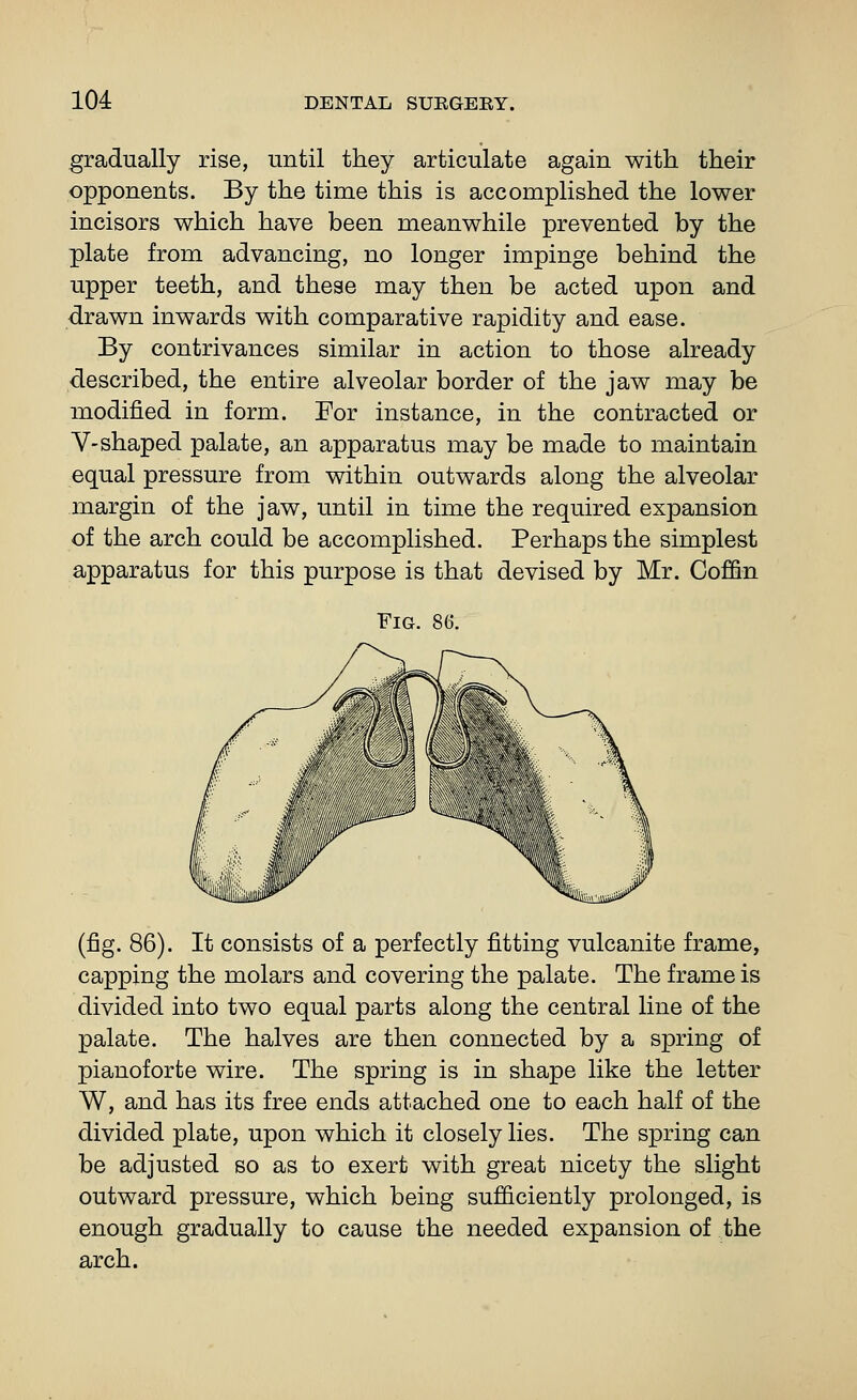 gradually rise, until they articulate again with their opponents. By the time this is accomplished the lower incisors which have been meanwhile prevented by the plate from advancing, no longer impinge behind the upper teeth, and these may then be acted upon and drawn inwards with comparative rapidity and ease. By contrivances similar in action to those already described, the entire alveolar border of the jaw may be modified in form. For instance, in the contracted or V-shaped palate, an apparatus may be made to maintain equal pressure from within outwards along the alveolar margin of the jaw, until in time the required expansion of the arch could be accomplished. Perhaps the simplest apparatus for this purpose is that devised by Mr. Coffin Fig. 86. (fig. 86). It consists of a perfectly fitting vulcanite frame, capping the molars and covering the palate. The frame is divided into two equal parts along the central line of the palate. The halves are then connected by a spring of pianoforte wire. The spring is in shape like the letter W, and has its free ends attached one to each half of the divided plate, upon which it closely lies. The spring can be adjusted so as to exert with great nicety the slight outward pressure, which being sufficiently prolonged, is enough gradually to cause the needed expansion of the arch.