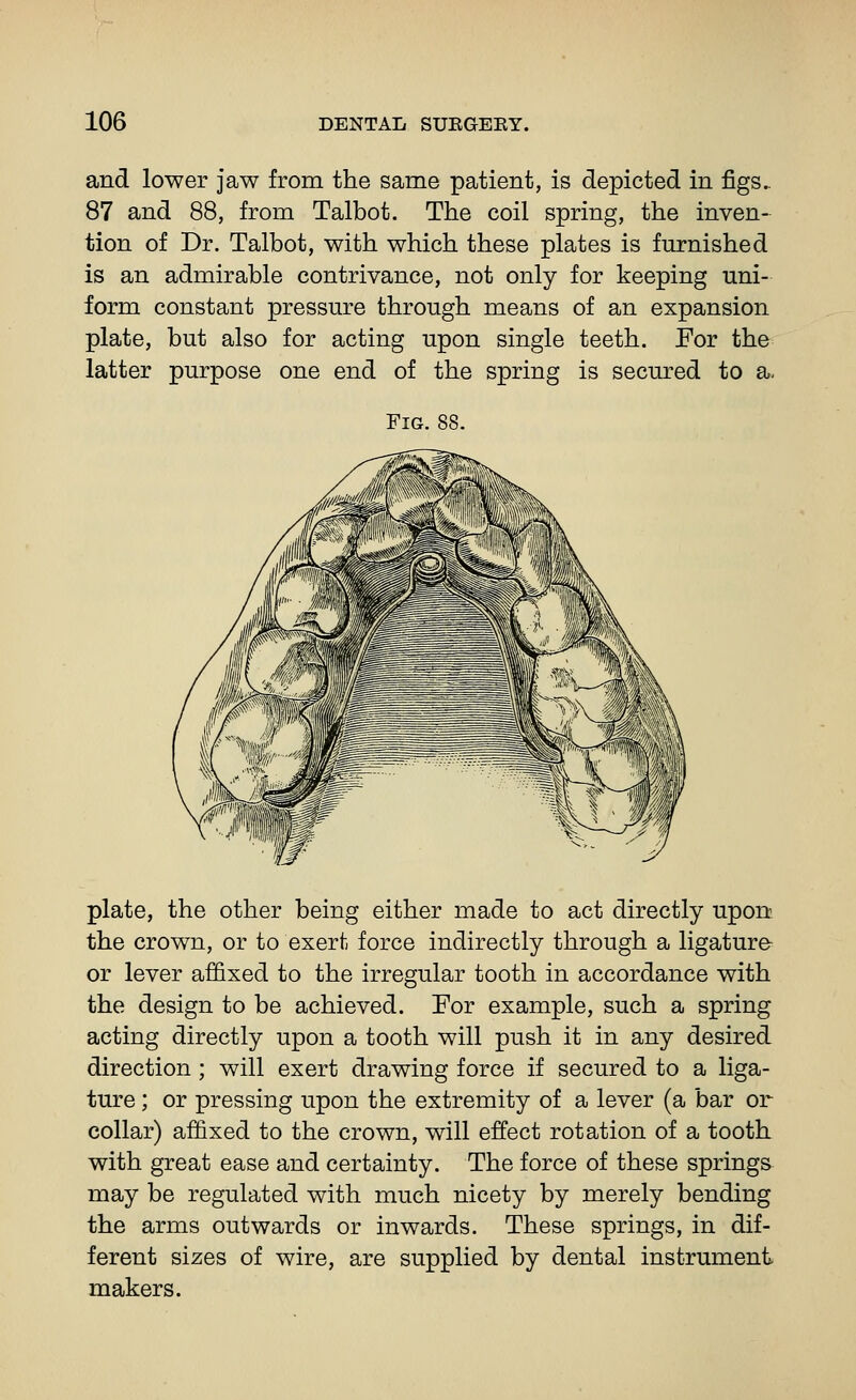 and lower jaw from the same patient, is depicted in figs. 87 and 88, from Talbot. The coil spring, the inven- tion of Dr. Talbot, with which these plates is furnished is an admirable contrivance, not only for keeping uni- form constant pressure through means of an expansion plate, but also for acting upon single teeth. For the latter purpose one end of the spring is secured to a- Fig. 88. plate, the other being either made to act directly uport the crown, or to exert force indirectly through a ligature or lever affixed to the irregular tooth in accordance with the design to be achieved. For example, such a spring acting directly upon a tooth will push it in any desired direction; will exert drawing force if secured to a liga- ture ; or pressing upon the extremity of a lever (a bar or collar) affixed to the crown, will effect rotation of a tootk with great ease and certainty. The force of these springs may be regulated with much nicety by merely bending the arms outwards or inwards. These springs, in dif- ferent sizes of wire, are supplied by dental instrument makers.