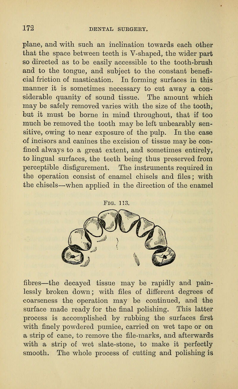 plane, and with such an inchnation towards each other that the space between teeth is V-shaped, the wider part so directed as to be easily accessible to the tooth-brush and to the tongue, and subject to the constant benefi- cial friction of mastication. In forming surfaces in this manner it is sometimes necessary to cut away a con- siderable quanity of sound tissue. The amount which may be safely removed varies with the size of the tooth, but it must be borne in mind throughout, that if too much be removed the tooth may be left unbearably sen- sitive, owing to near exposure of the pulp. In the case of incisors and canines the excision of tissue may be con- fined always to a great extent, and sometimes entirely, to lingual surfaces, the teeth being thus preserved from perceptible disfigurement. The instruments required in the operation consist of enamel chisels and files; with the chisels—when applied in the direction of the enamel Fig. 113. fibres—the decayed tissue may be rapidly and pain- lessly broken down; with files of different degrees of coarseness the operation may be continued, and the surface made ready for the final polishing. This latter process is accomplished by rubbing the surfaces first with finely powdered pumice, carried on wet tape or on a strip of cane, to remove the file-marks, and afterwards with a strip of wet slate-stone, to make it perfectly smooth. The whole process of cutting and polishing is