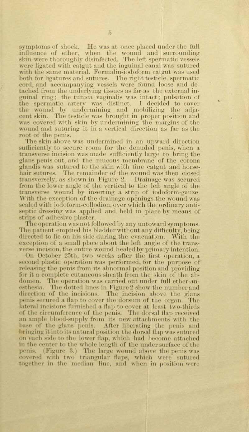 symptoms of shock. He was at once jjlaced under the full influence of ether, when the wound and surrounding skin wore thoroughly di^^infeeted. The left spermatic vessels were ligated with catgut and the inguinal canal was sutured with the same material. Formalin-iodoform catgut was used both for ligatures and sutures. The right testicle, spermatic cord, and accompanying vessels were found loose and de- tached from the underlying tissues as far as the external in- guinal ring; the tunica vaginalis was intact; pulsation of the spermatic artery was distinct. I decided to cover the wound by undermining and mobilizing the adja- cent skin. The testicle was brought in proper position and was covered with skin by undermining the margins of the wound and suturing it in a vertical direction as fa^r as the root of the penis. The skin al>ove was undermined in an upward direction sufficiently to secure room for the denuded penis, when a transverse incision was made sufficiently large to bring the glans penis out, and the mucous membrane of the corona glandis \\as sutured to the skin with hue catgut and horse- hair sutures. The remainder of the wound was then closed transversely, as shown in Figure 2. Drainage was secured from the lower angle of the vertical to the left angle of the tran.sverse wound by inserting a strip of iodoform-gavize. With the exception of the drainage-openings the wound was sealed with iodoform-collodion, over which the ordinary anti- septic dressing was ap^jlied and held in place by means of strips of adhesive plaster. The operation was not followed by any untoward symptoms. The patient emptied his bladder without any difficulty, being directed to lie on his side during the evacuation. With the exception of a small place al)Out the left angle of the trans- verse incision, the entire wound healedby primary intention. On October 2oth, two weeks after the first operation, a second plastic ojtei-ation was performed, for the i)urpose of relea.'^ing the penis from its abnormal position and pi-oviding for it a complete cutaneous slu!ath from the skin of the ab- domen. The operation was carried out under full ether-an- esthesia. The dittted lines in Figure 2 show the number and <lirection of the incisions. The incision above the glans j>enis secured a Hap to cover the dorsum of the organ. The lat(;ral incisions furnished a Hap to cover at least two-thirds of the circumference of tlu; penis. Tin; dorsal llaj) received an ample blood-supply from its n(!W attachments with the bas(! of the glans jicnis. After liberating the penis and bringing it into its natural position the dor.sal Hap was sutured on each side to the lower Haj), which had become attached in the center to the whoU; Ic^ngth of the under surface of the penis. (Figure 3.) The large wound aitove the penis was covered with two triangular Haps, which were sutured together in the median Mne, and when in ])osition wen;