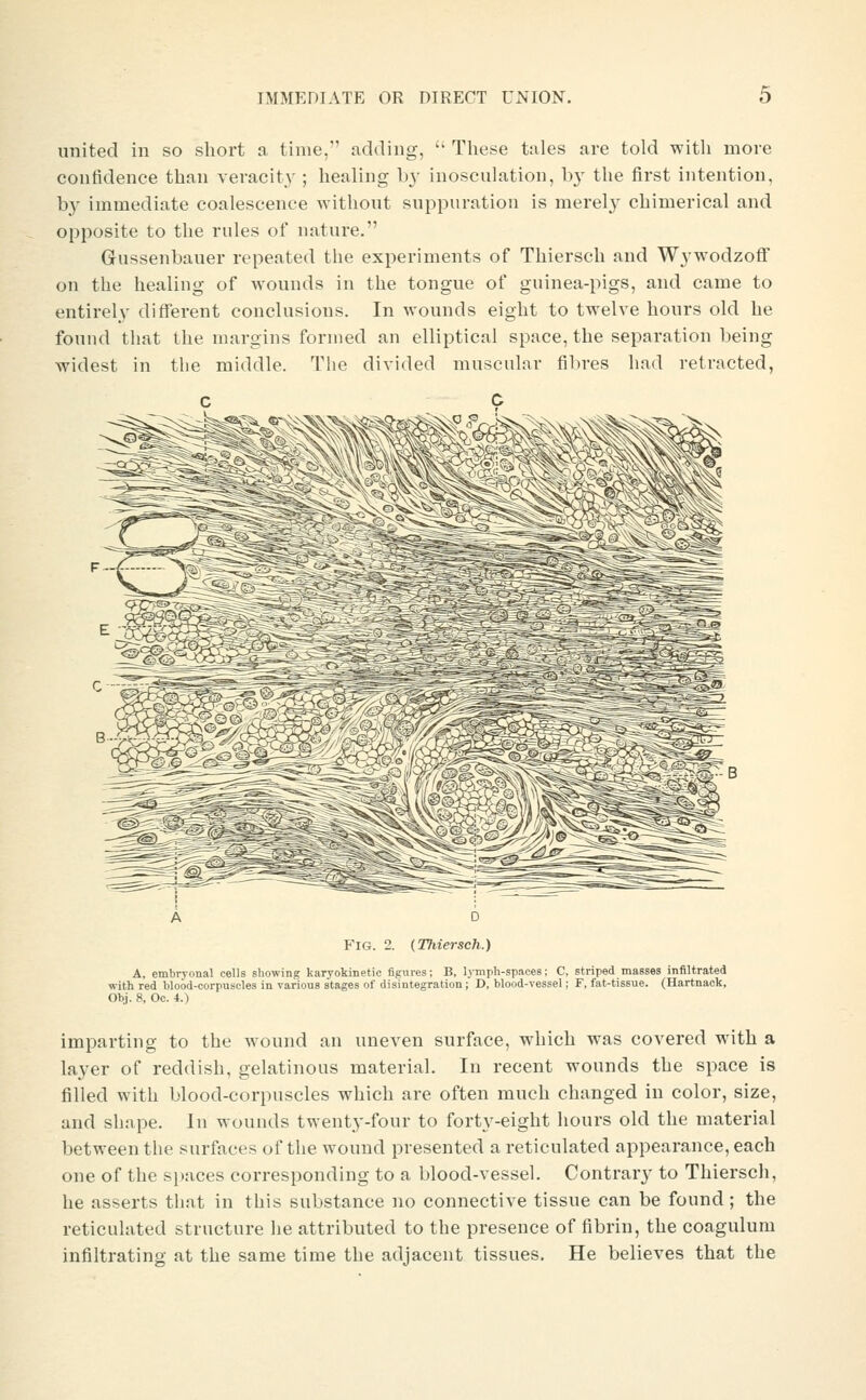 united in so short a time, adding,  These tales are told with more confidence than veracity ; healing by inosculation, by the first intention, by immediate coalescence without suppuration is merel}' chimerical and opposite to the rules of nature. Gussenbauer repeated the experiments of Thiersch and Wywodzoff on the healing of wounds in the tongue of guinea-pigs, and came to entirely different conclusions. In wounds eight to twelve hours old he found that the margins formed an elliptical space, the separation being widest in the middle. The divided muscular fibres had retracted, Fig. 2. (Thiersch.) A, embryonal cells showing karyokinetic figures; B, lymph-spaces; C, striped masses infiltrated with red blood-corpuscles in various stages of disintegration; D, blood-vessel; F, fat-tissue. (Hartnack, Obj. 8, Oe. 4.) imparting to the wound an uneven surface, which was covered with a layer of reddish, gelatinous material. In recent wounds the space is filled with blood-corpuscles which are often much changed in color, size, and shape. In wounds twenty-four to forty-eight hours old the material between the surfaces of the wound presented a reticulated appearance, each one of the s[)aces corresponding to a blood-vessel. Contrary to Thiersch, he asserts that in this substance no connective tissue can be found ; the reticulated structure he attributed to the presence of fibrin, the coagulum infiltrating at the same time the adjacent tissues. He believes that the