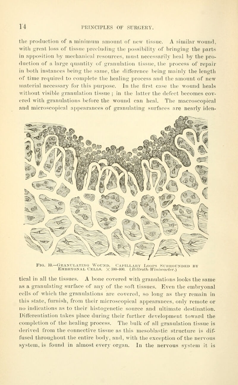 tlie prodiietioii of a miiiiinuin :iiiioiiiit of lu'W tissue. A similar wound, witii grt'ut loss of tissue prec-luding the possibility of bringing the parts in api)osition by mechanical resources, nuist necessarily heal by the pro- duction of a large quantity of granulation tissue, the process of repair in both instances J)eing the same, the difference being mainly the length of time required to comj)lete the healing process and the amount of new material necessary for this purpose. In the first c.ise the wound heals witliout visible granulation tissue ; in the latf er the defect becomes cov- ered with granulations before the wound can heal. The macroscopical and microscopical ni)pearances of granulating surfaces nre nearly iden- -^ vr % i;^-^! ^ 1 f^m n£' v^- Fig. 10.—Granulating Wound. Capillary Loops Surrounded by Embryonal Cells, x 300-400. (Billroth-Winiwarter.) tical in all the tissues. A bone covered with granulations looks the same as a granulating surface of any of the soft tissues. Even the embryonal cells of which tlie granulations are covered, so long as they remain in this state, furnish, from their microscopical appearances, only remote or no indications as to their histogenetic source and ultimate destination. Differentiation takes place during their further development toward the completion of the healing process. The l)ulk of all granulation tissue is derived from the connective tissue as this mesoblastic structure is dif- fused throughout the entire bod}^ and, with the exception of the nervous system, is found in almost every organ. In the nervous sjstem it is