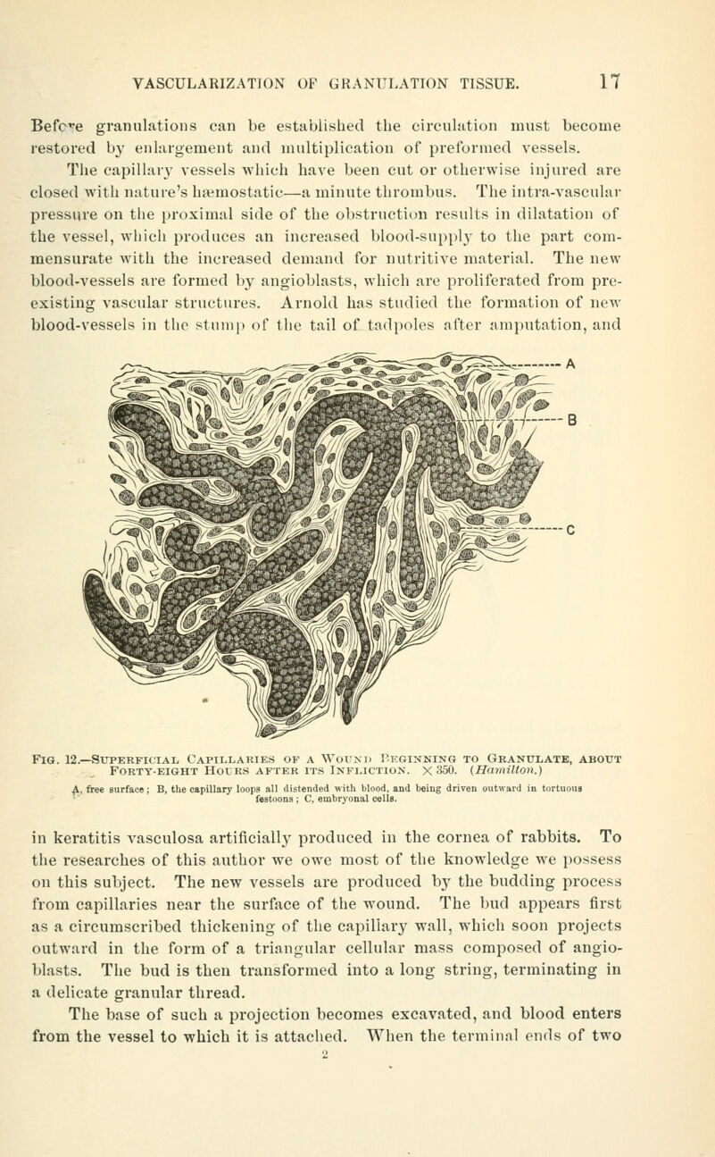 Befc^e granulations can be established the circulation must become restored by enlargement and multiplication of preformed vessels. The capillar}' vessels which have been cut or otherwise injured are closed with nature's htemostatic—a minute thrombus. The intra-vascular pressure on the proximal side of the obstruction results in dilatation of the vessel, which produces an increased blood-supply to the part com- mensurate with the increased demand for nutritive material. The new blood-vessels are formed by angioblasts, which are proliferated from pre- existing vascular structures. Arnold has studied the formation of new blood-vessels in the stump of the tail of tadpoles after amputation, and Fig. 12.—Superficial Capillaries op a Wound Beginning to Granulate, about Forty-eight Holrs after its Infliction. X 350. {Hamilton.) ^, free surface ; B, tlie capillary loops all distended with blood, and being driven outward in tortuous festoons ; C, embryonal cells. in keratitis vasculosa artificiall}^ produced in the cornea of rabbits. To the researches of this author we owe most of the knowledge we possess on this subject. The new vessels are produced by the budding process from capillaries near the surface of the wound. The bud appears first as a circumscribed thickening of the capillary wall, which soon projects outward in the form of a triangular cellular mass composed of angio- blasts. The bud is then transformed into a long string, terminating in a delicate granular thread. The base of such a projection becomes excavated, and blood enters from the vessel to which it is attached. When the terminal ends of two 2