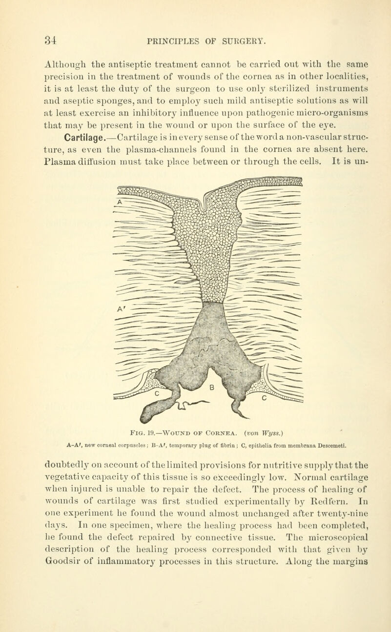 Although the antiseptic treatment cannot be carried out with the same precision in the treatment of wounds of tlie cornea as in other localities, it is at least the duty of the surgeon to use only sterilized instruments and aseptic sponges, and to employ such mild antiseptic solutions as will at least exercise an inhibitory influence upon pathogenic micro-organisms that may be present in the wound or upon the surface of the eye. Cartilage.—Cartilage is in every sense of the word a non-vascular struc- ture, as even the plasma-channels found in the cornea are absent here. Plasma diffusion must take place between or through the cells. It is un- FiG. 19.—Wound of Cornea, {von Wpss.) A-A', new corneal corpuscles ; B-A', temporary plug of fibrin ; C, epithelia from membrana Descemeti. doubtedly on account of thelimited provisions for nutritive supply that the vegetative capacity of this tissue is so exceedingly low. Normal cartilage when injured is unable to repair the defect. The process of healing of Avounds of cartilage was first studied experimentally by Redfern. In one experiment he found the wound almost unchanged after twenty-nine days. In one specimen, where the healing process had been completed, he found the defect repaired by connective tissue. The microscopical description of the healing process corresponded witli that given by Goodsir of inflammatory processes in this structure. Along the margins