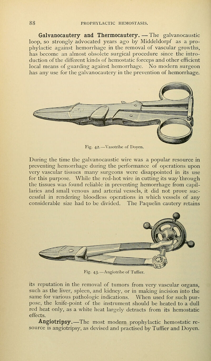 Galvanocautery and Thermocautery. — The galvanocaustic loop, so strongly advocated years ago by Middeldorpf as a pro- phylactic against hemorrhage in the removal of vascular growths, has become an almost obsolete surgical procedure since the intro- duction of the different kinds of hemostatic forceps and other efficient local means of guarding against hemorrhage. No modern surgeon has any use for the galvanocautery in the prevention of hemorrhage. Fig. 42.—Vasotribe of Doyen. During the time the galvanocaustic wire was a popular resource in preventing hemorrhage during the performance of operations upon very vascular tissues many surgeons were disappointed in its use for this purpose. While the red-hot wire in cutting its way through the tissues was found reliable in preventing hemorrhage from capil- laries and small venous and arterial vessels, it did not prove suc- cessful in rendering bloodless operations in which vessels of any considerable size had to be divided. The Paquelin cautery retains > /. jAr A^, Fig. 43.—Angiotribe of Tuffier. its reputation in the removal of tumors from very vascular organs, such as the liver, spleen, and kidney, or in making incision into the same for various pathologic indications. When used for such pur- pose, the knife-point of the instrument should be heated to a dull red heat only, as a white heat largely detracts from its hemostatic effects. Angiotripsy.—The most modern prophylactic hemostatic re- source is angiotripsy, as devised and practised by Tuffier and Doyen.