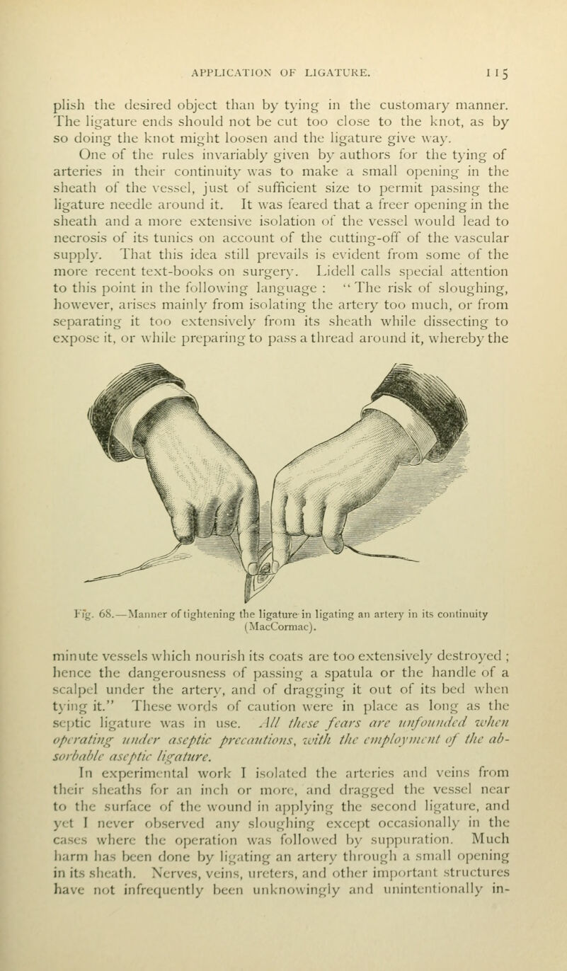 plish the desired object than by tying in the customary manner. The Hgature ends should not be cut too close to the knot, as by so doing the knot might loosen and the ligature give way. One of the rules invariably given by authors for the tying of arteries in their continuity was to make a small opening in the sheath of the vessel, just of sufficient size to permit passing the ligature needle around it. It was feared that a freer opening in the sheath and a more extensive isolation of the vessel would lead to necrosis of its tunics on account of the cutting-off of the vascular supply. That this idea still prevails is evident from some of the more recent text-books on surgery. Lidell calls special attention to this point in the following language : The risk of sloughing, however, arises mainly from isolating the artery too much, or from separating it too extensively from its sheath while dissecting to expose it, or while preparing to pass a thread around it, whereby the l-fg. 68.—Manner of tightening the ligature in ligating an artery in its continuity (MacComiac). minute vessels which nourish its coats are too extensively destroyed ; lience the dangerousness of pa.ssing a spatula or the handle of a scalpel under the artery, and of dragging it out of its bed when t)ing it. These words of caution were in place as long as the septic ligature was in use. All these fears arc luifouiidcd when operating tinder aseptic precautions, with the eniploynient of the ab- sorbable aseptic ligature. In experimental work I isolated the arteries and veins from their sheaths for an inch or more, and dragged the vessel near to the surface of the wound in applying the second ligature, and yet I never observed any sloughing except occasionally in the cases where the operation was followed by suppuration. Much harm has been done by ligating an artery through a small opening in its sheath. Nerves, veins, ureters, and other important structures have not infrequently been unknowingly and unintentionally in-