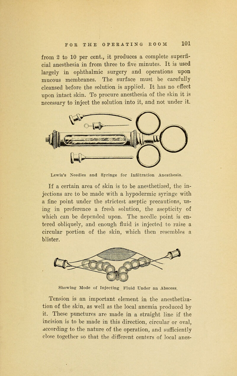 from 2 to 10 per cent., it produces a complete superfi- cial anesthesia in from three to five minutes. It is used largely in ophthalmic surgery and operations upon mucous membranes. The surface must be carefully cleansed before the solution is applied. It has no effect upon intact skin. To procure anesthesia of the skin it is necessary to inject the solution into it, and not under it. Lewis's Needles and Syringe for Infiltration Anestliesia. If a certain area of skin is to be anesthetized, the in- jections are to be made with a hypodermic syringe with a fine point under the strictest aseptic precautions, us- ing in preference a fresh solution, the asepticity of which can be depended upon. The needle point is en- tered obliquely, and enough fluid is injected to raise a circular portion of the skin, which then resembles a blister. Sliowing Mode of Injecting Fluid Under an Abscess. Tension is an important element in the anesthetiza- tion of the skin, as well as the local anemia produced by it. These punctures are made in a straight line if the incision is to be made in this direction, circular or oval, according to the nature of the operation, and sufficiently close together so that the different centers of local anes-