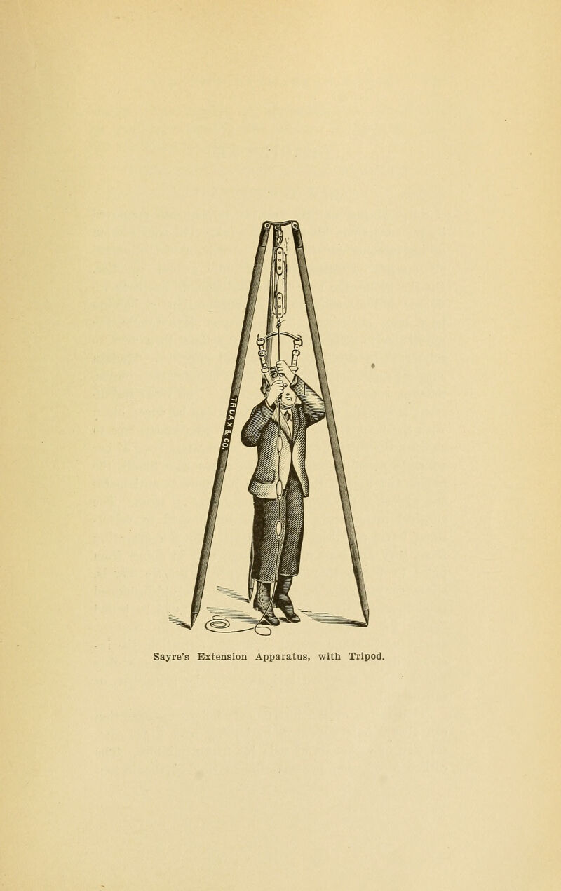 Sayre's Extension Apparatus, with Tripod,