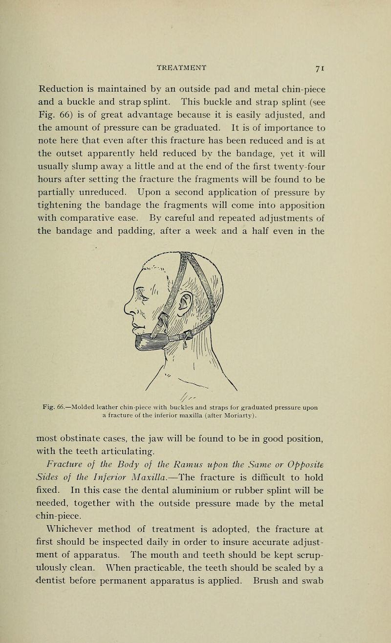 Reduction is maintained by an outside pad and metal chin-piece and a buckle and strap splint. This buckle and strap splint (see Fig. 66) is of great advantage because it is easily adjusted, and the amount of pressure can be graduated. It is of importance to note here that even after this fracture has been reduced and is at the outset apparently held reduced by the bandage, yet it will usually slump away a little and at the end of the first twenty-four liours after setting the fracture the fragments will be found to be partially unreduced. Upon a second application of pressure by tightening the bandage the fragments will come into apposition with comparative ease. By careful and repeated adjustments of the bandage and padding, after a week and a half even in the Fig. (A.—Molded leather chin-piece with buckles and straps for graduated pressure upon a fracture of the inferior maxilla (after Moriarty). most obstinate cases, the jaw will be found to be in good position, with the teeth articulating. Fracture of the Body of the Rmnus upon the Same or Opposite ■Sides of the Inferior Maxilla.—The fracture is difhcult to hold fixed. In this case the dental aluminium or rubber splint will be needed, together with the outside pressure made by the metal chin-piece. Whichever method of treatment is adopted, the fracture at first should be inspected daily in order to insure accurate adjust- ment of apparatus. The mouth and teeth should be kept scrup- ulously clean. When practicable, the teeth should be scaled by a •dentist before permanent apparatus is applied. Brush and swab