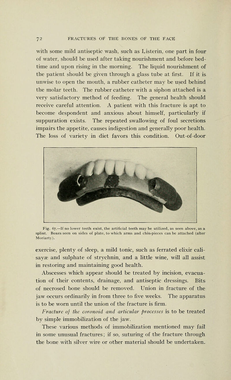 ^vith some mild antiseptic wash, such as Listerin, one part in four of water, should be used after taking nourishment and before bed- time and upon rising in the morning. The liquid nourishment of the patient should be given through a glass tube at first. If it is unwise to open the mouth, a rubber catheter may be used behind the molar teeth. The rubber catheter with a siphon attached is a very satisfactorv method of feeding. The general health should receive careful attention. A patient with this fracture is apt to become despondent and anxious about himself, particularly if suppuration exists. The repeated swallowing of foul secretions impairs the appetite, causes indigestion and generally poor health. The loss of variety in diet favors this condition. Out-of-door Fig. 67.—If no lower teeth exist, the artificial teeth may be utilized, as seen above, as a splint. Boxes seen on sides of plate, to which arms and chin-pieces can be attached (after Moriarty). exercise, plenty of sleep, a mild tonic, such as ferrated elixir cali- sayae and sulphate of strychnin, and a little wine, will all assist in restoring and maintaining good health. Abscesses which appear should be treated by incision, evacua- tion of their contents, drainage, and antiseptic dressings. Bits of necrosed bone should be removed. Union in fracture of the jaw occurs ordinarily in from three to five weeks. The apparatus is to be worn until the union of the fracture is firm. Fracture of the coronoid and articular processes is to be treated by simple immobilization of the jaw. These various methods of immobilization mentioned may fail in some unusual fractures; if so, suturing of the fracture through the bone with silver wire or other material should be undertaken.