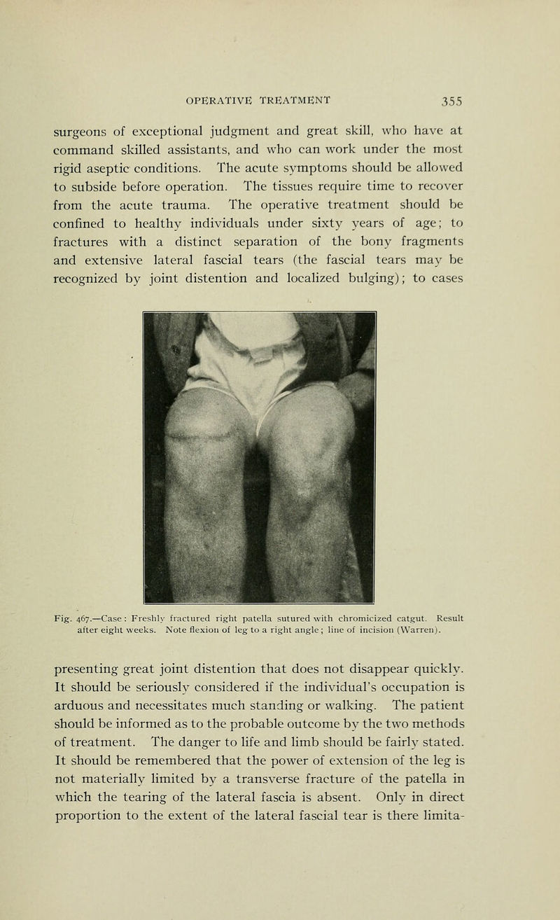 surgeons of exceptional judgment and great skill, who have at command skilled assistants, and who can work under the most rigid aseptic conditions. The acute symptoms should be allowed to subside before operation. The tissues require time to recover from the acute trauma. The operative treatment should be confined to healthy individuals under sixty years of age; to fractures with a distinct separation of the bony fragments and extensive lateral fascial tears (the fascial tears may be recognized by joint distention and localized bulging); to cases Fig. 467.—Case : Freshly fractured right patella sutured with chromicized catgut. Result after eight weeks. Note flexion of leg to a right angle ; line of incision (Warren). presenting great joint distention that does not disappear quickly. It should be seriously considered if the individual's occupation is arduous and necessitates much standing or walking. The patient should be informed as to the probable outcome bv the two methods of treatment. The danger to life and limb should be fairly stated. It should be remembered that the power of extension of the leg is not materially limited by a transverse fracture of the patella in which the tearing of the lateral fascia is absent. Only in direct proportion to the extent of the lateral fascial tear is there limita-