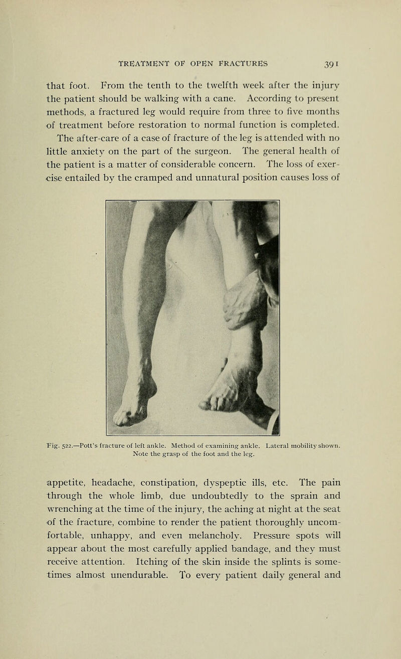 that foot. From the tenth to the twelfth week after the injury the patient should be walking with a cane. According to present methods, a fractured leg would require from three to five months of treatment before restoration to normal function is completed. The after-care of a case of fracture of the leg is attended with no little anxiety on the part of the surgeon. The general health of the patient is a matter of considerable concern. The loss of exer- cise entailed by the cramped and unnatural position causes loss of ■pig. 522.—Pott's fracture of left ankle. Method of examining ankle. Lateral mobility shown. Note the grasp of the foot and the leg. appetite, headache, constipation, dyspeptic ills, etc. The pain through the whole limb, due undoubtedly to the sprain and wrenching at the time of the injury, the aching at night at the seat •of the fracture, combine to render the patient thoroughly uncom- fortable, unhappy, and even melancholy. Pressure spots will appear about the most carefully applied bandage, and they must receive attention. Itching of the skin inside the splints is some- times almost unendurable. To every patient daily general and