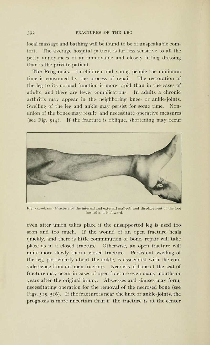 local massage and bathing will be found to be of unspeakable com- fort. The average hospital patient is far less sensitive to all the pettv annovances of an immovable and closely fitting dressing than is the private patient. The Prognosis.—In children and ^■()ung people the minimum time is consumed bv the process of repair. The restoration of the leg to its normal function is more rapid than in the cases of adults, and there are fewer complications. In adults a chronic arthritis may appear in the neighboring knee- or ankle-joints. vSwelling of the leg and ankle may persist for some time. Non- union of the bones may result, and necessitate operative measures (see Fig. 514). If the fracture is oblique, shortening mav occur Fig. 523.—Case : Fracture of the internal and external malleoli and displacement of the foot inward and backward. even after union takes place if the unsupported leg is used too- soon and too much. If the wound of an open fracture heals quickly, and there is little comminution of bone, repair will take place as in a closed fracture. Otherwise, an open fracture will unite more slowly than a closed fracture. Persistent swelling of the leg, particularlv about the ankle, is associated with the con- valescence from an open fracture. Necrosis of bone at the seat of fracture may occur in cases of open fracture even many months or years after the original injury. Abscesses and sinuses may form, necessitating operation for the removal of the necrosed bone (see Figs. 515, 516). If the fracture is near the knee or ankle-joints, the prognosis is more uncertain than if the fracture is at the center