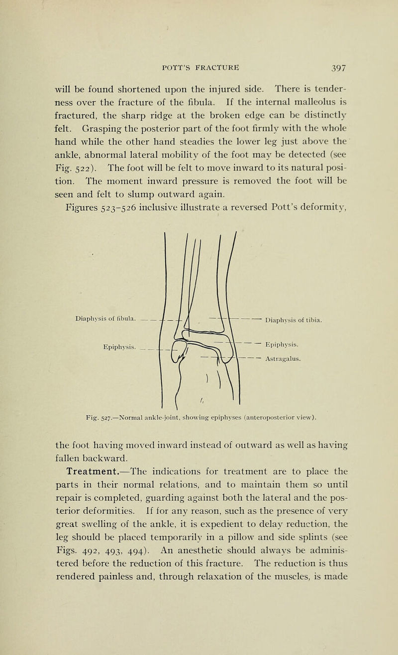 will be found shortened upon the injured side. There is tender- ness over the fracture of the fibula. If the internal malleolus is fractured, the sharp ridge at the broken edge can be distinctly felt. Grasping the posterior part of the foot firmly with the whole hand while the other hand steadies the lower leg just above the ankle, abnormal lateral mobility of the foot may be detected (see Fig. 522). The foot will be felt to move inward to its natural posi- tion. The moment inward pressure is removed the foot will be seen and felt to slump outward again. Figures 523-526 inclusive illustrate a reversed Pott's deformity. Diaph\sis of fibula. Epiphysis. _ Diaphysis of tibia. Epiphysis. Astraealus. Fig. 527.—Normal ankle-joint, showing epiphyses (anteroposterior view). the foot having moved inward instead of outward as well as having fallen backward. Treatment.—The indications for treatment are to place the parts in their normal relations, and to maintain them so until repair is completed, guarding against both the lateral and the pos- terior deformities. If for any reason, such as the presence of very great swelling of the ankle, it is expedient to delay reduction, the leg should be placed temporarily in a pillow and side splints (see Figs. 492, 493, 494). An anesthetic should always be adminis- tered before the reduction of this fracture. The reduction is thus rendered painless and, through relaxation of the muscles, is made