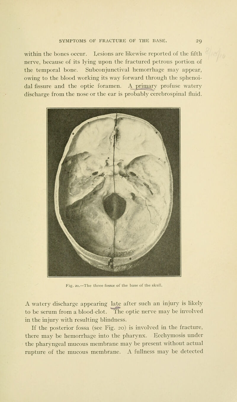 within the bones oecur. Lesions are hkewise reported of the fifth nerve, because of its lying upon the fractured petrous portion of the temporal bone. Subconjunctival hemorrhage may appear, owing to the blood working its way forward through the sphenoi- dal fissure and the optic foramen. A primarv profuse watery discharge from the nose or the ear is probably cerebrospinal fluid. Fig. 20.—The three fossae of the base of the skull. A watery discharge appearing late after such an injury is likely to be serum from a blood-clot. The optic nerve may be involved in the injury with resulting blindness. If the posterior fossa (see Fig. 20) is involved in the fracture, there may be hemorrhage into the phars'nx. Ecchymosis under the pharyngeal mucous membrane may^ be present wdthout actual rupture of the mucous membrane. A fullness may be detected