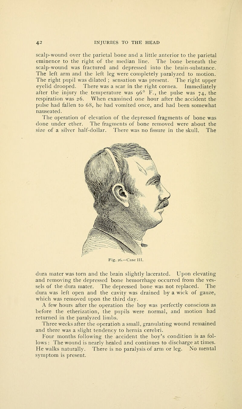 scalp-wound over the parietal bone and a little anterior to the parietal eminence to the right of the median line. The bone beneath the scalp-wound was fractured and depressed into the brain-substance. The left arm and the left leg were completely paralyzed to motion. The right pupil was dilated ; sensation was present. The right upper eyelid drooped. There was a scar in the right cornea. Immediately after the injury the temperature was 96° F., the pulse was 74, the respiration was 26. When examined one hour after the accident the pulse had fallen to 68, he had vomited once, and had been somewhat nauseated. The operation of elevation of the depressed fragments of bone was done under ether. The fragments of bone removed were about the size of a silver half-dollar. There was no fissure in the skull. The Fig. 26.—Case III. dura mater was torn and the brain slightly lacerated. Upon elevating and removing the depressed bone hemorrhage occurred from the ves- sels of the dura mater. The depressed bone was not replaced. The dura was left open and the cavity was drained by a wick of gauze, which was removed upon the third day. A few hours after the operation the boy was perfectly conscious as before the etherization, the pupils were normal, and motion had returned in the paralyzed limbs. Three weeks after the operation a small, granulating wound remained and there was a slight tendency to hernia cerebri. Four months following the accident the boy's condition is as fol- lows : The wound is nearly healed and continues to discharge at times. He walks naturally. There is no paralysis of arm or leg. No mental symptom is present.