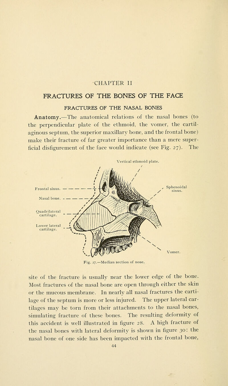 CHAPTER II FRACTURES OF THE BONES OF THE FACE FRACTURES OF THE NASAL BONES Anatomy.—The anatomical relations of the nasal bones (to the perpendicular plate of the ethmoid, the vomer, the cartil- aginous septum, the superior maxillary bone, and the frontal bone) make their fracture of far greater importance than a mere super- ficial disfigurement of the face would indicate (see Fig. 27). The Vertical ethmoid plate. Frontal sinus. Nasal bone. Quadrilateral cartilage. Lower lateral cartilage. , Sphenoidal sinus. Vomer. Fig. 27.—Median section of nose. site of the fracture is usually near the lower edge of the bone. Most fractures of the nasal bone are open through either the skin or the mucous membrane. In nearly all nasal fractures the carti- lage of the septum is more or less injured. The upper lateral car- tilages may be torn from their attachments to the nasal bones, simulating fracture of these bones. The resulting deformity of this accident is well illustrated in figure 28. A high fracture of the nasal bones with lateral deformity is shown in figure 30: the nasal bone of one side has been impacted with the frontal bone,